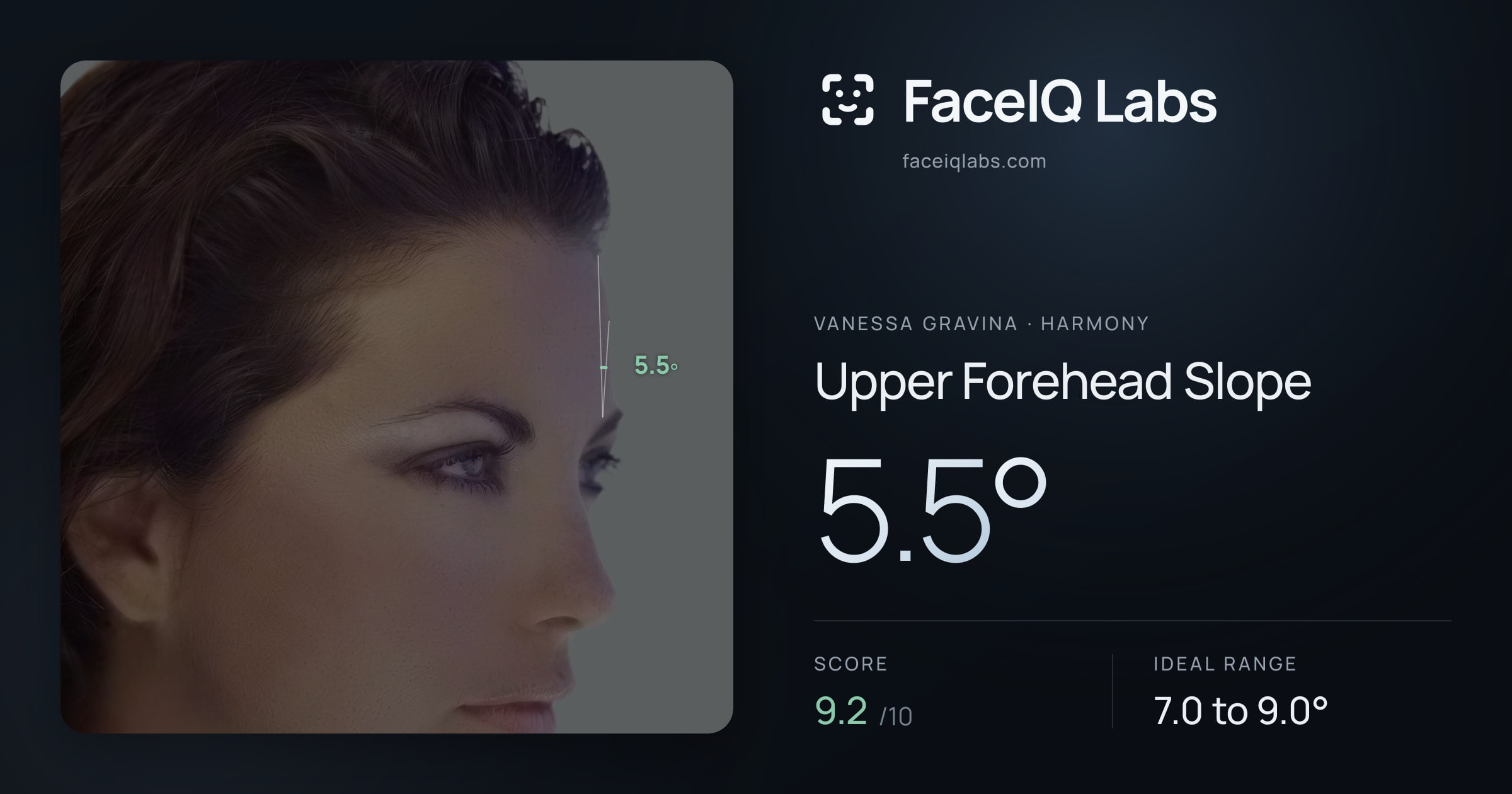 Vanessa Gravina Upper Forehead Slope: 5.5°, drawn on the photo