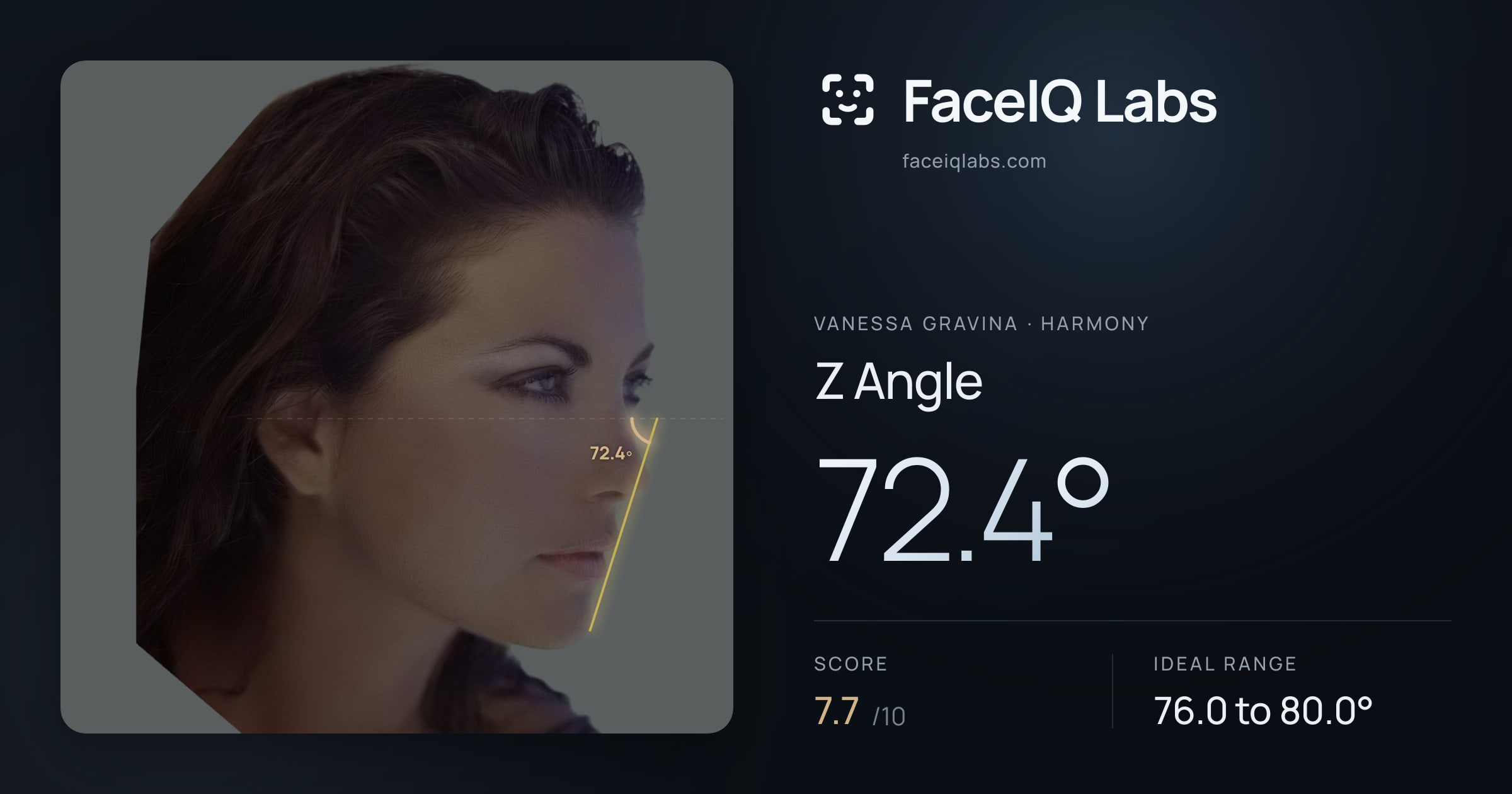 Vanessa Gravina Z Angle: 72.4°, drawn on the photo