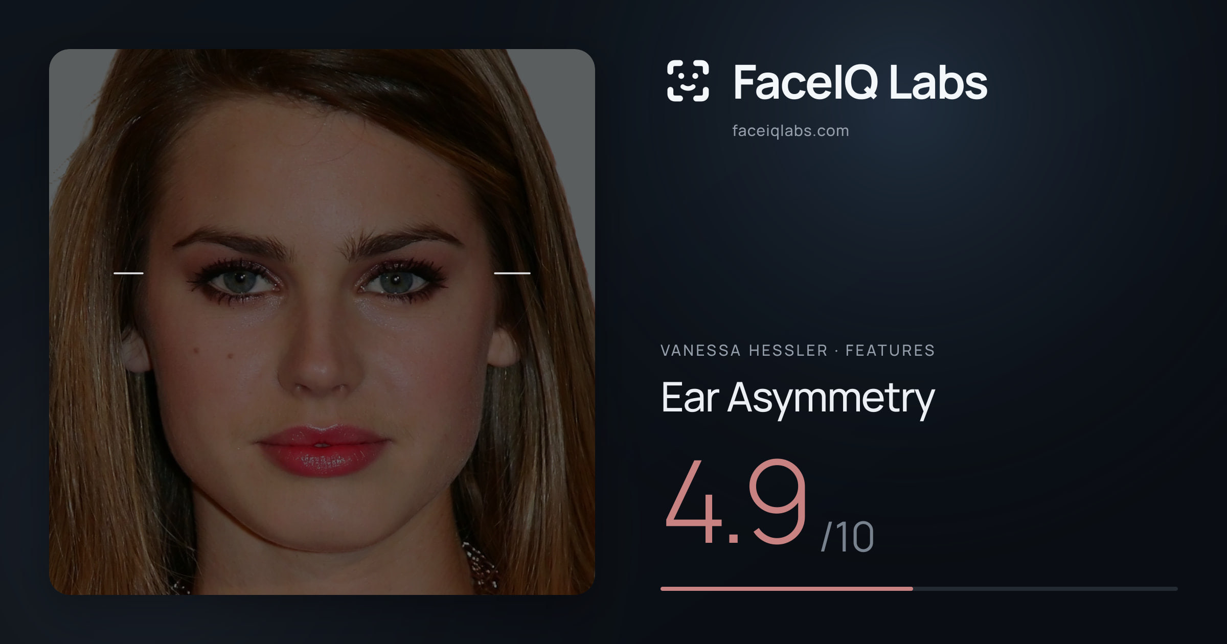 Vanessa Hessler Ear Asymmetry: 4.9/10, drawn on the photo