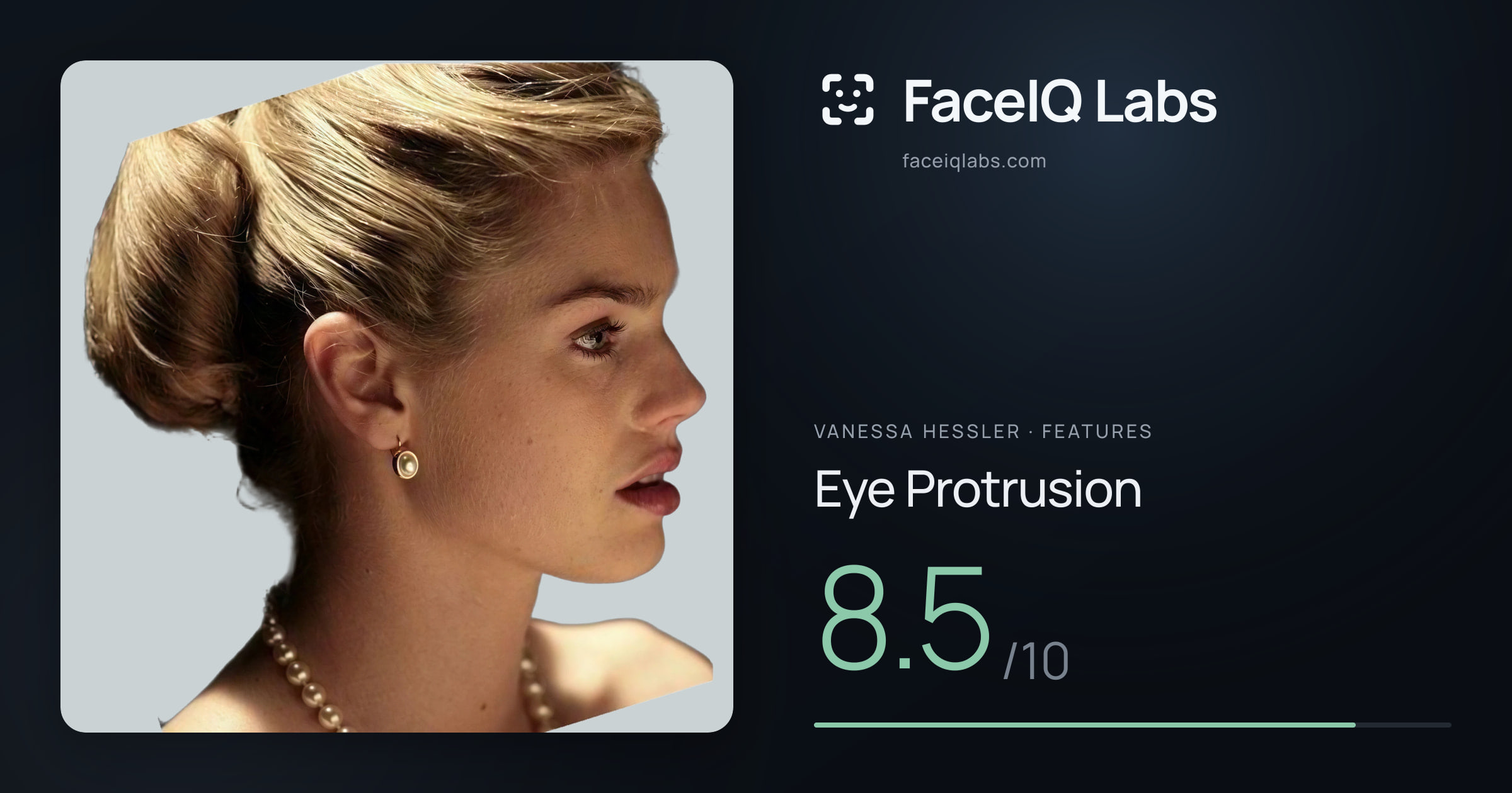 Vanessa Hessler Eye Protrusion: 8.5/10, drawn on the photo