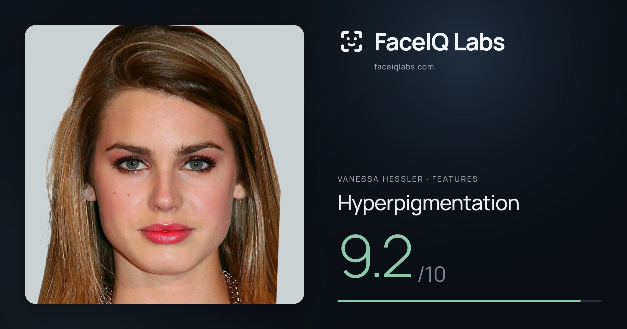 Vanessa Hessler Hyperpigmentation: 9.2/10, drawn on the photo