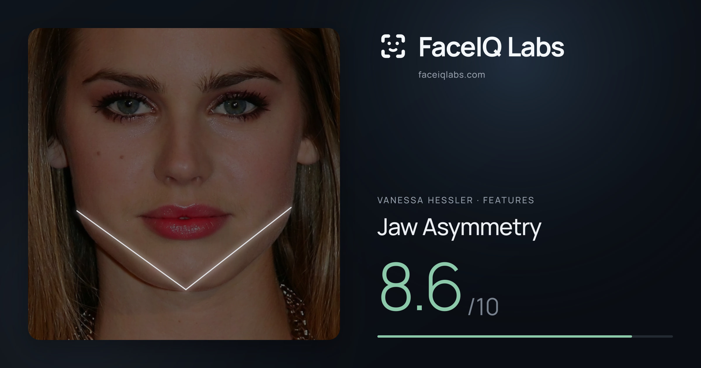 Vanessa Hessler Jaw Asymmetry: 8.6/10, drawn on the photo