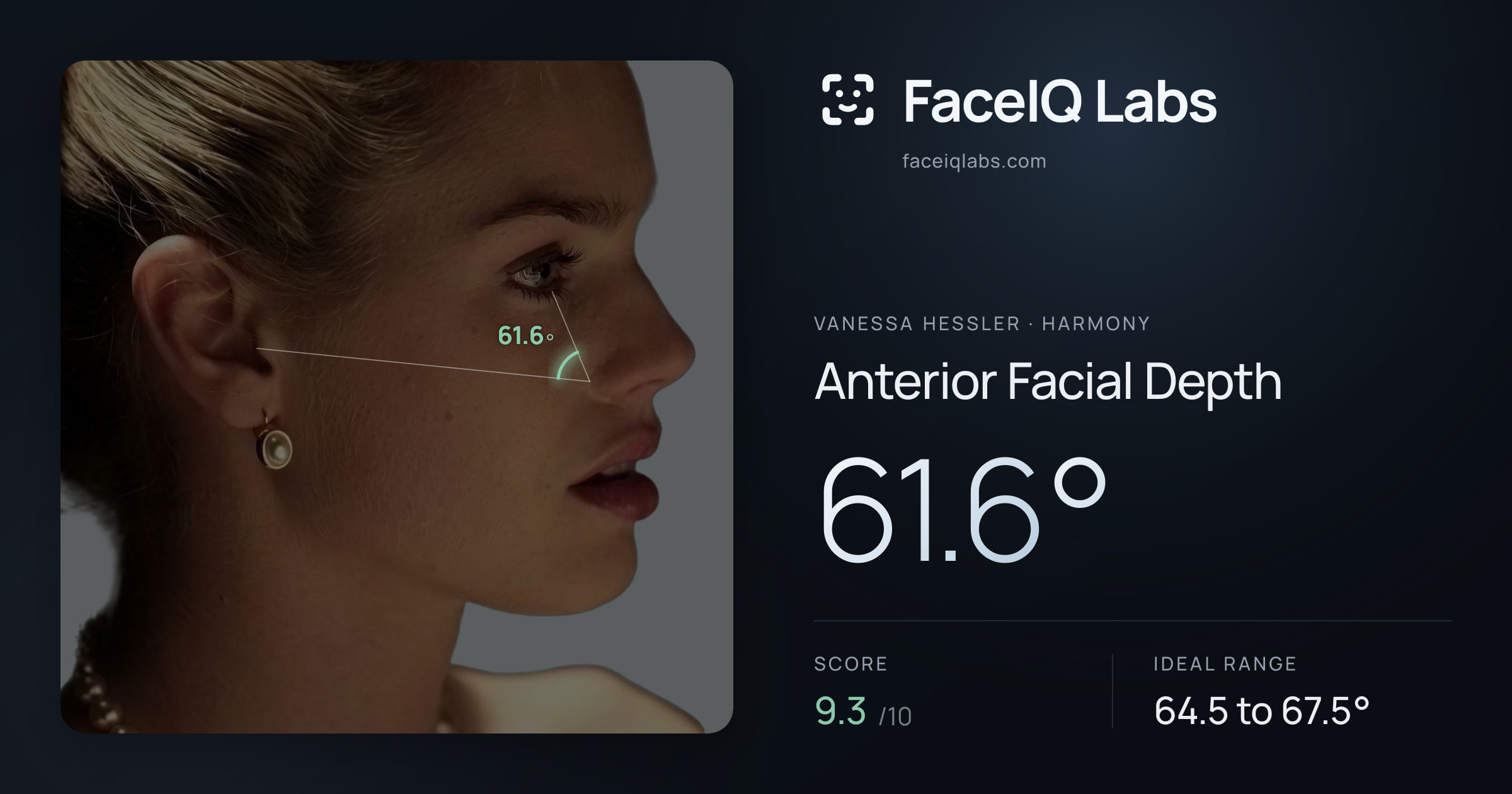 Vanessa Hessler Anterior Facial Depth: 61.6°, drawn on the photo