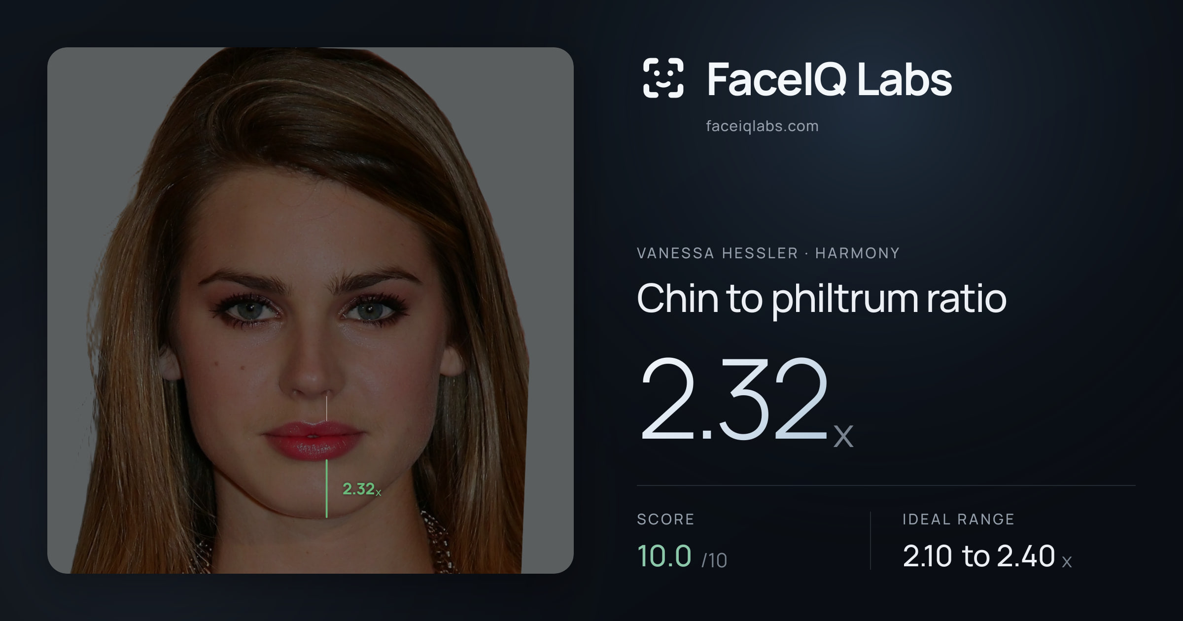 Vanessa Hessler Chin to philtrum ratio: 2.32x, drawn on the photo