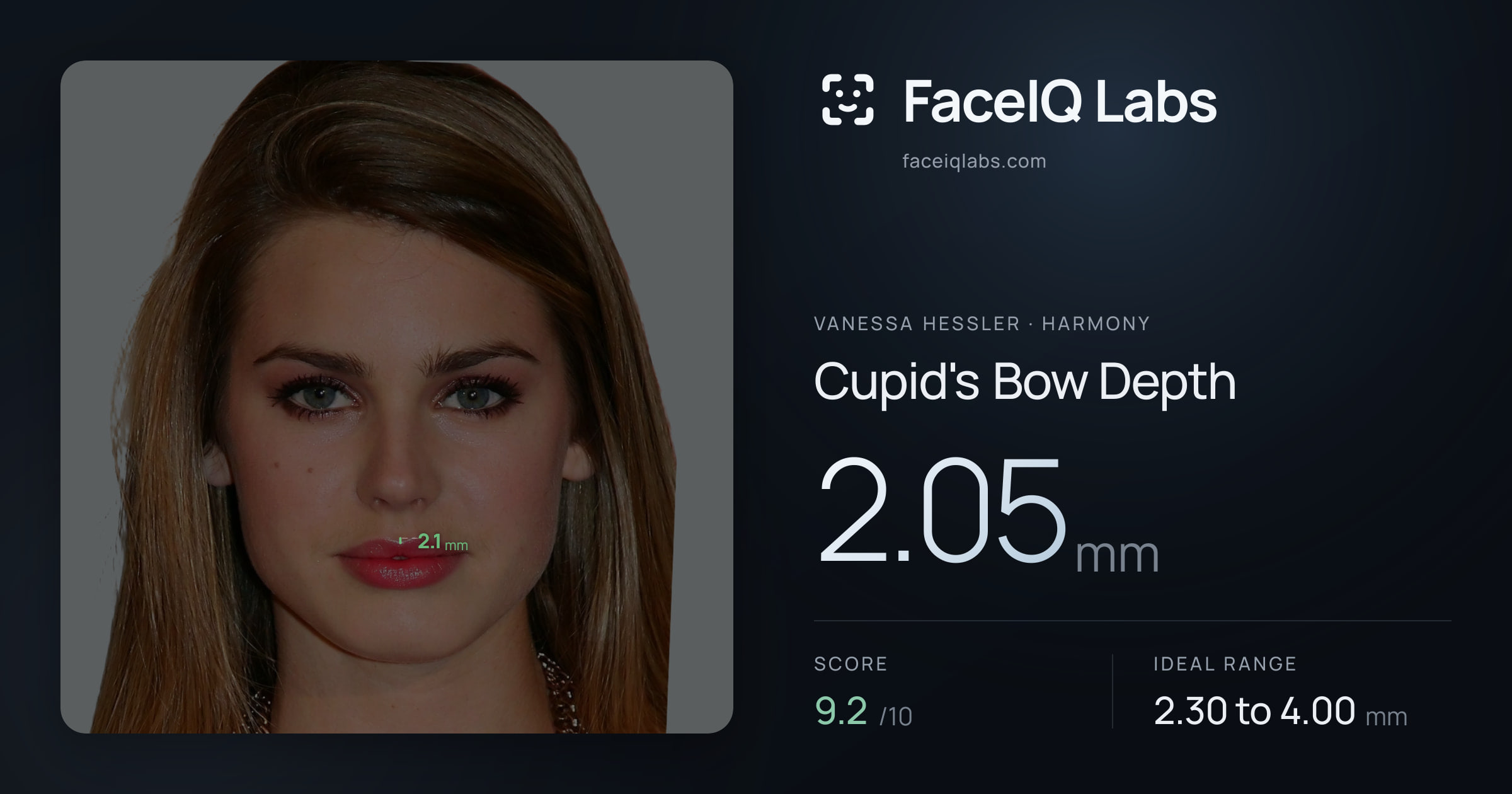 Vanessa Hessler Cupid's Bow Depth: 2.05mm, drawn on the photo