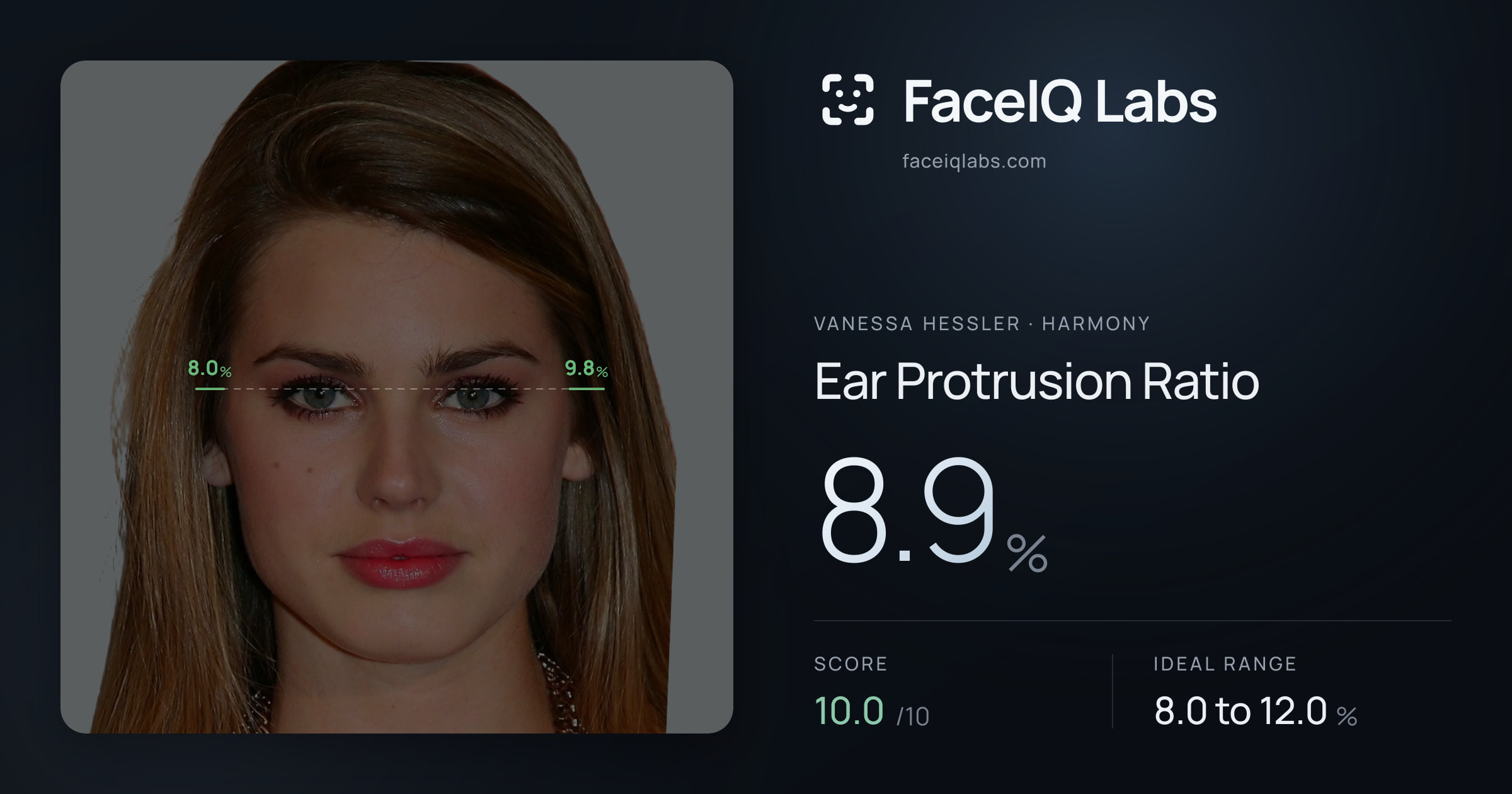Vanessa Hessler Ear Protrusion Ratio: 8.9%, drawn on the photo
