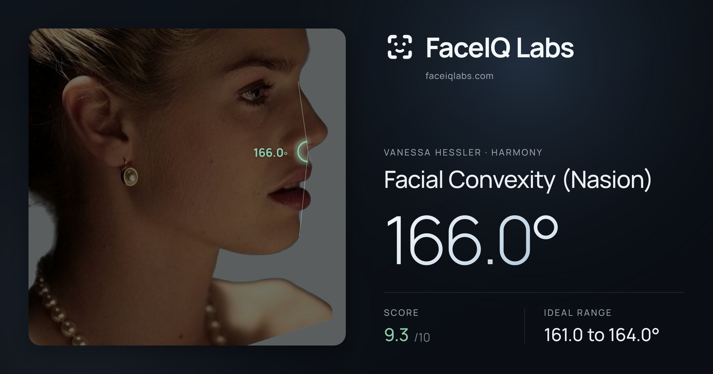 Vanessa Hessler Facial Convexity (Nasion): 166.0°, drawn on the photo
