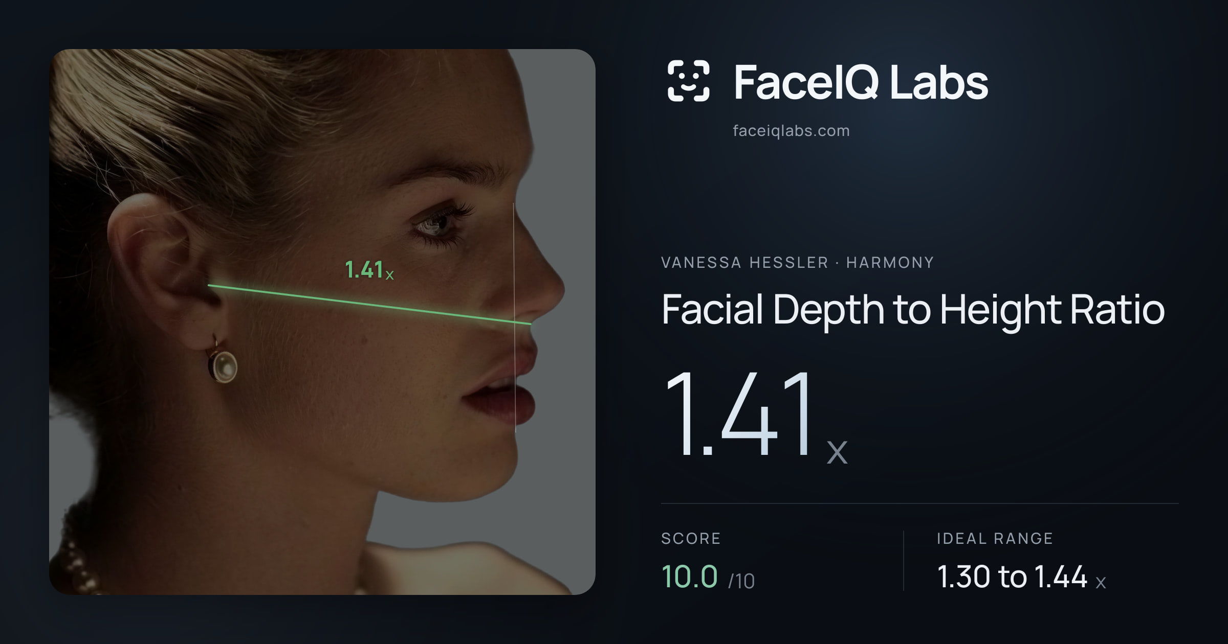Vanessa Hessler Facial Depth to Height Ratio: 1.41x, drawn on the photo