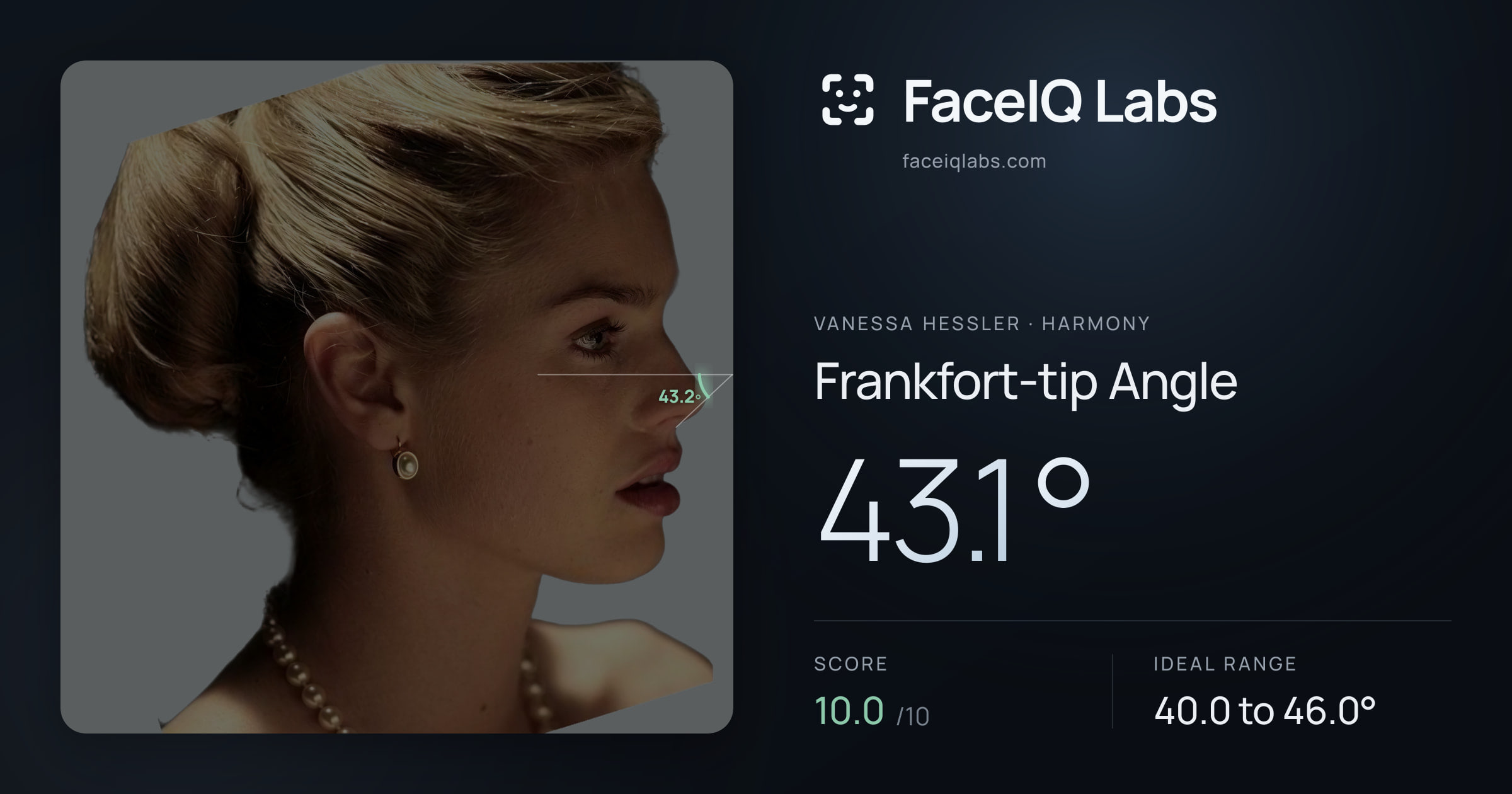 Vanessa Hessler Frankfort-tip Angle: 43.1°, drawn on the photo