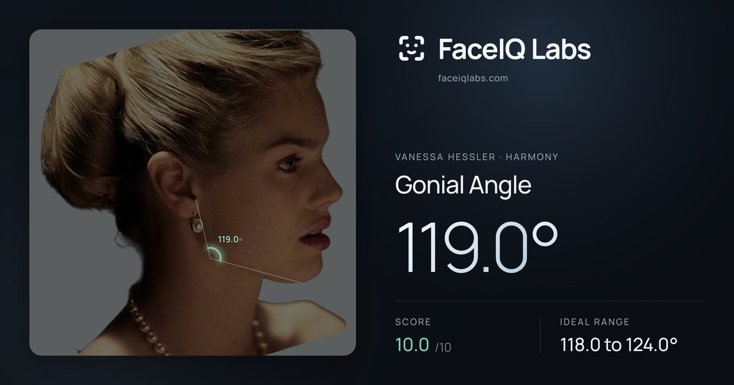 Vanessa Hessler Gonial Angle: 119.0°, drawn on the photo