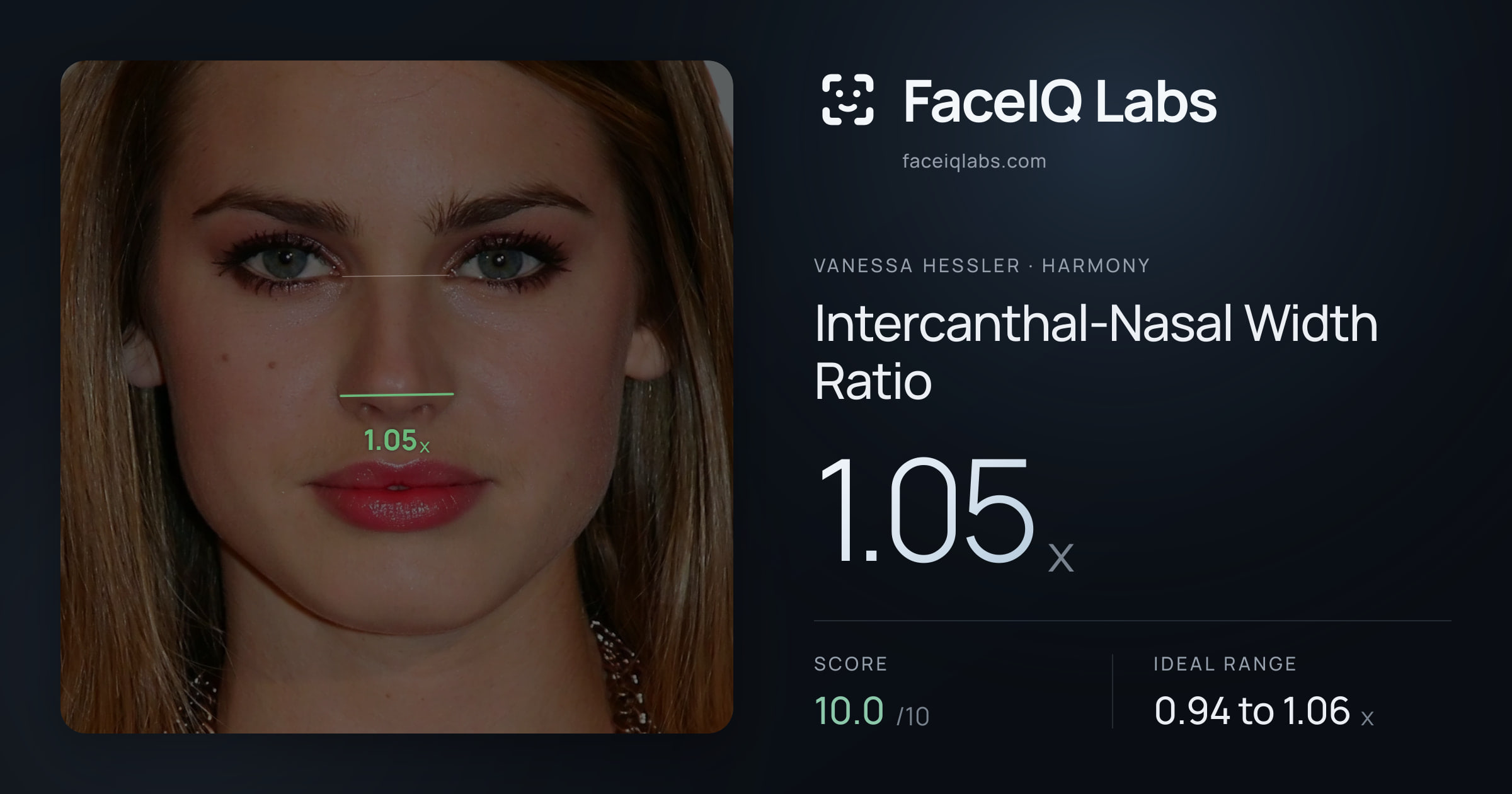 Vanessa Hessler Intercanthal-Nasal Width Ratio: 1.05x, drawn on the photo