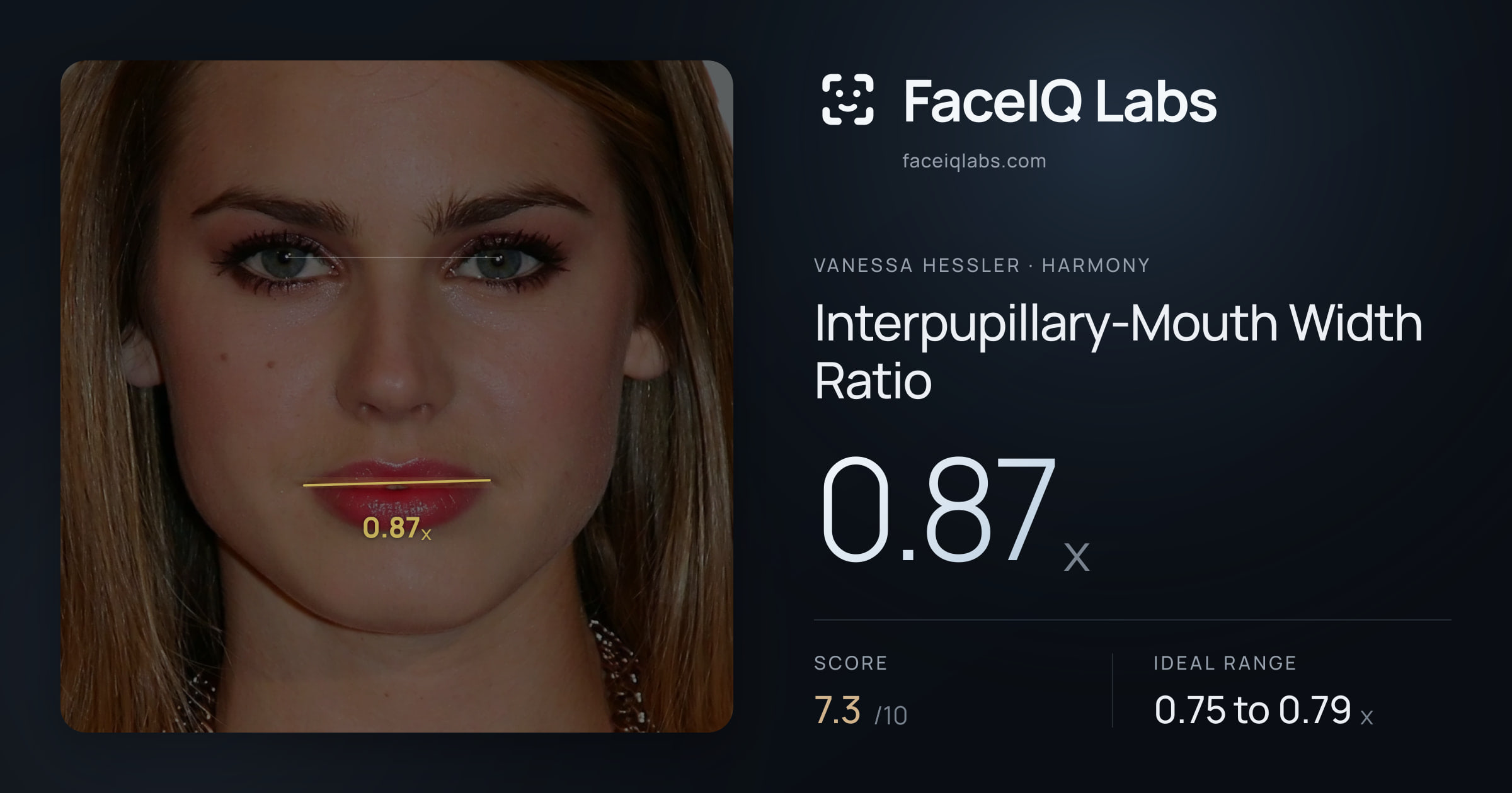 Vanessa Hessler Interpupillary-Mouth Width Ratio: 0.87x, drawn on the photo