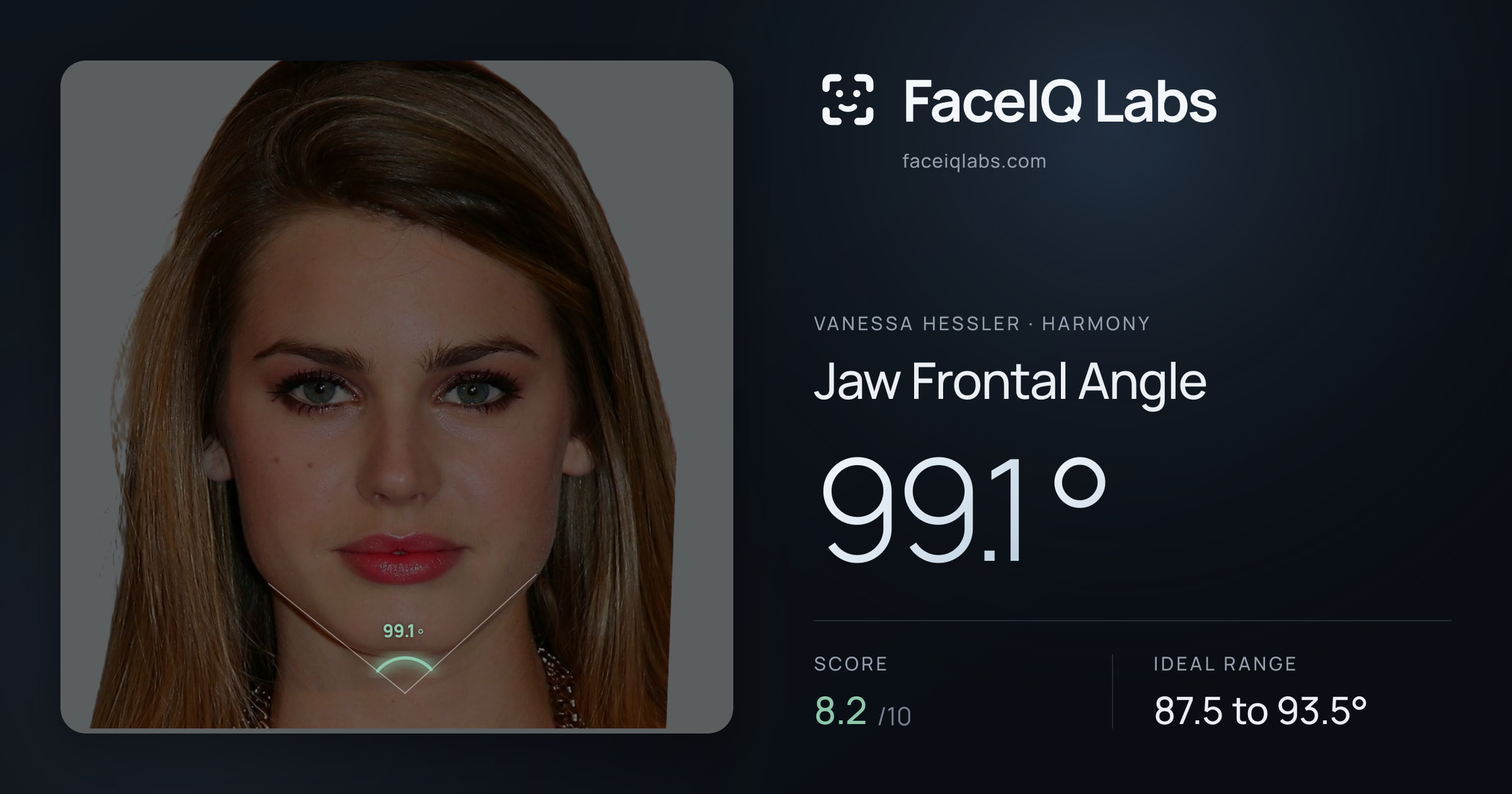 Vanessa Hessler Jaw Frontal Angle: 99.1°, drawn on the photo