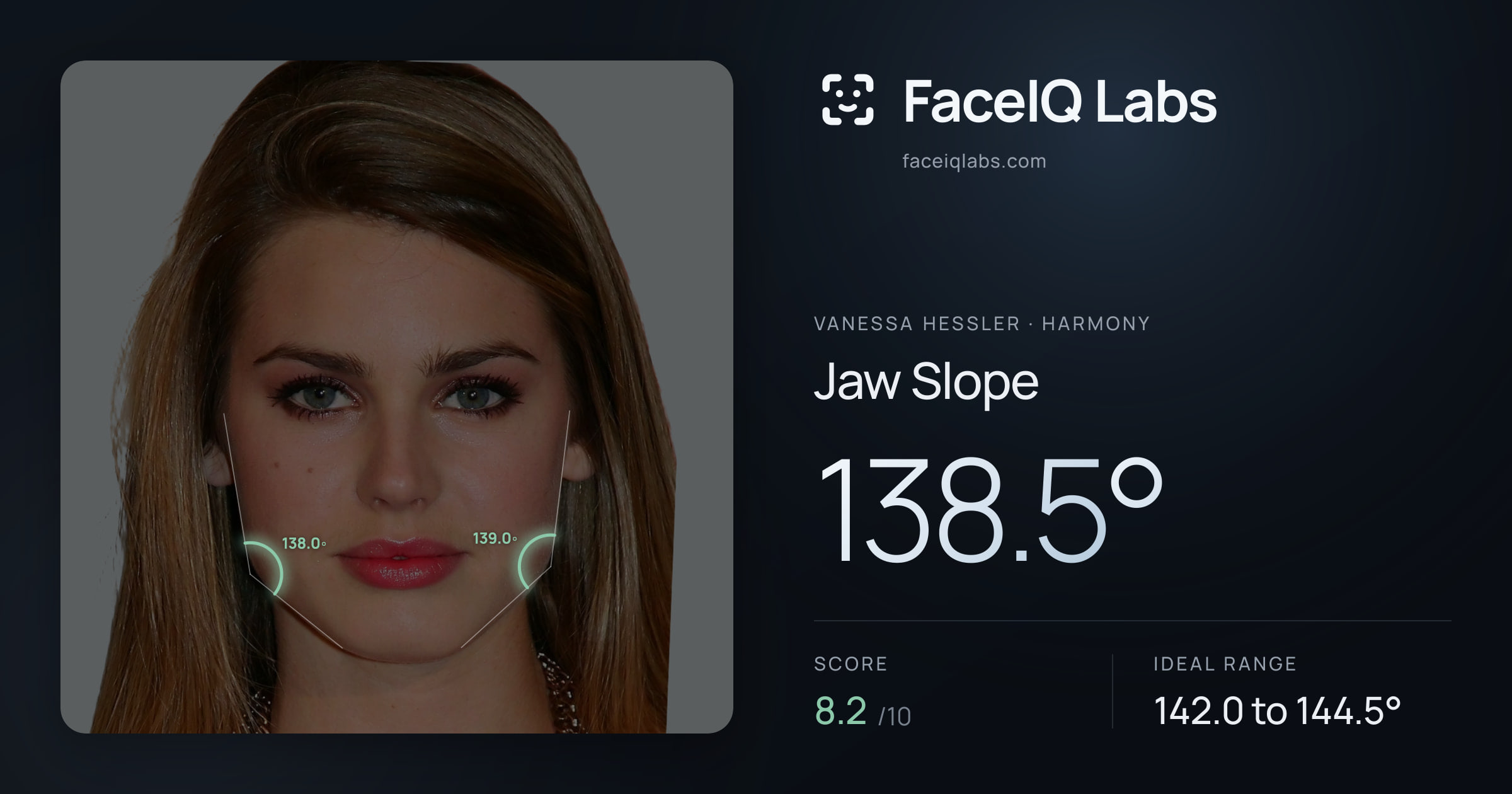 Vanessa Hessler Jaw Slope: 138.5°, drawn on the photo