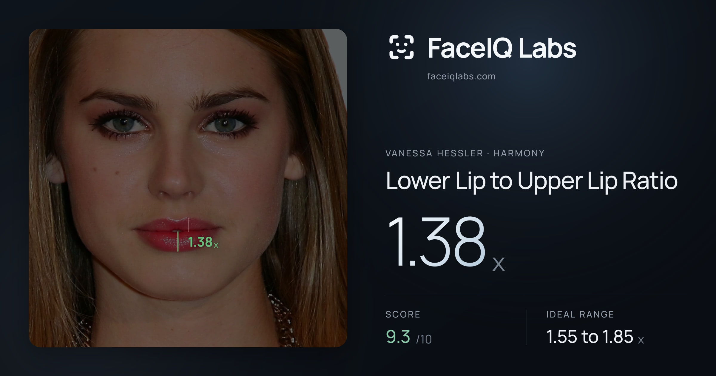 Vanessa Hessler Lower Lip to Upper Lip Ratio: 1.38x, drawn on the photo