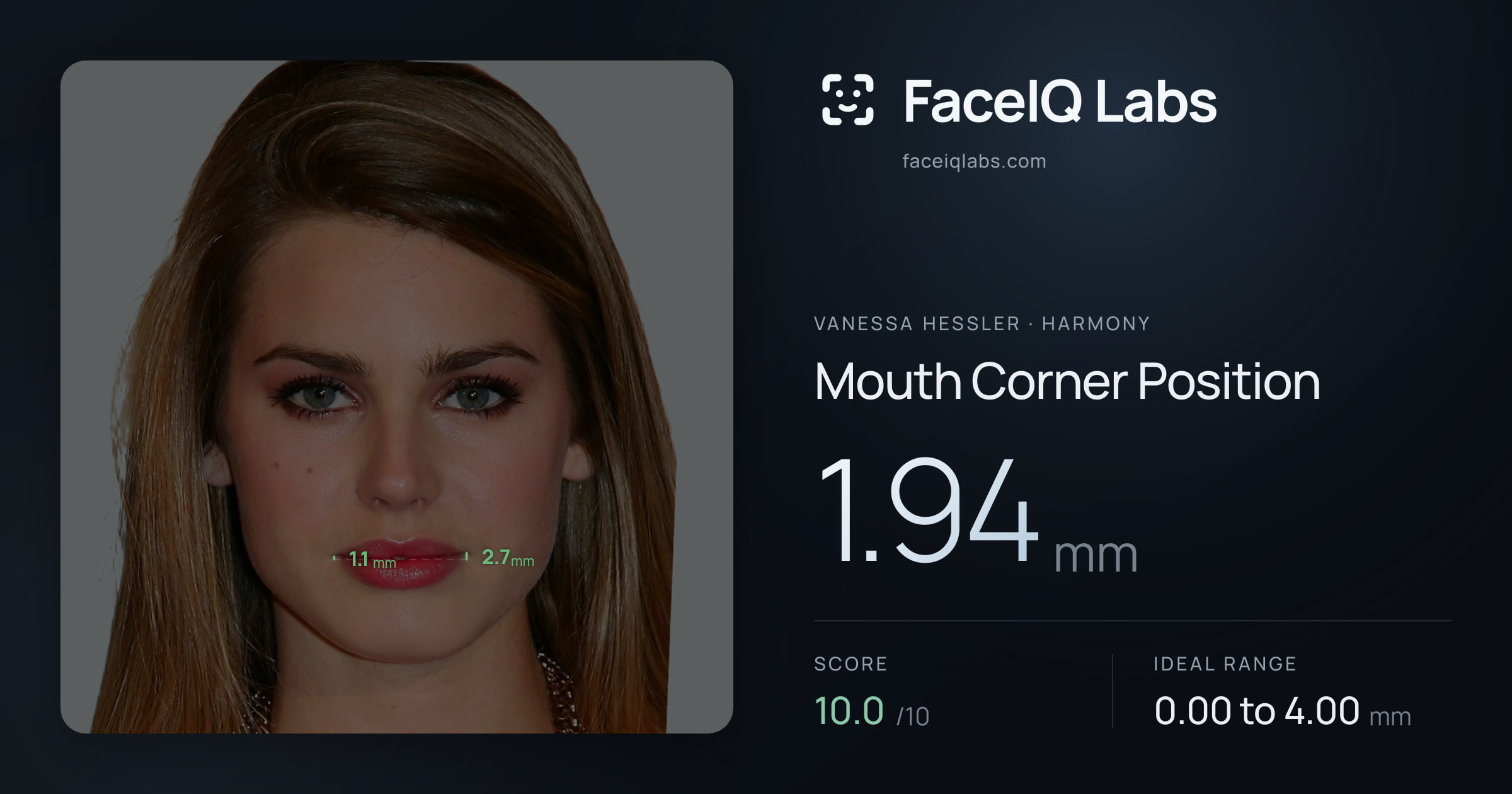 Vanessa Hessler Mouth Corner Position: 1.94mm, drawn on the photo
