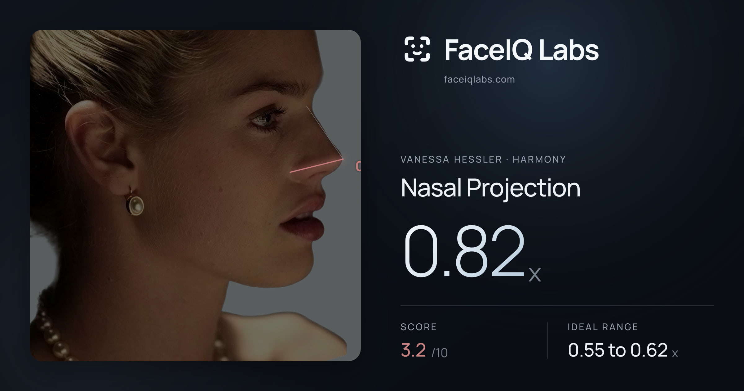 Vanessa Hessler Nasal Projection: 0.82x, drawn on the photo