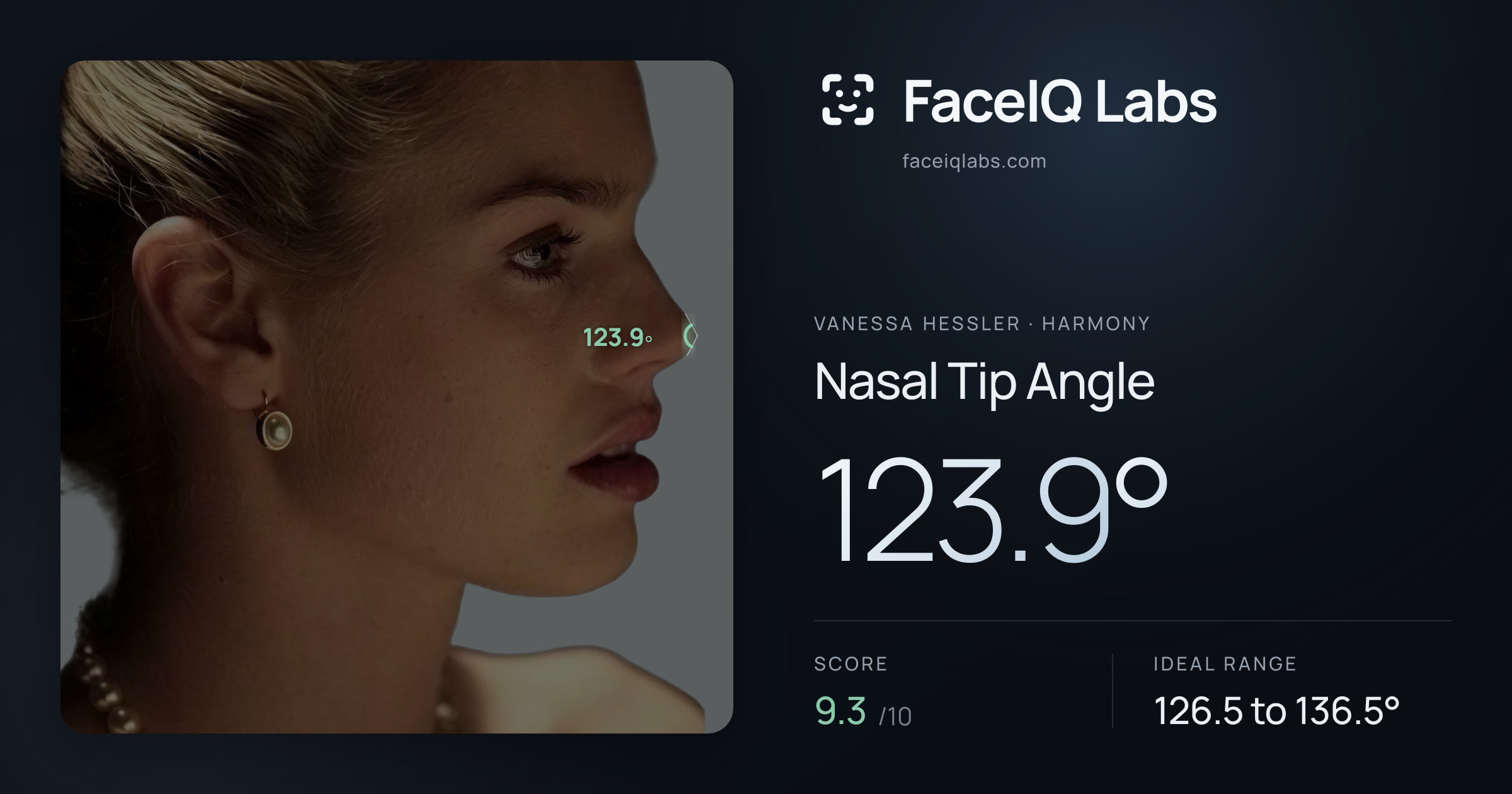 Vanessa Hessler Nasal Tip Angle: 123.9°, drawn on the photo