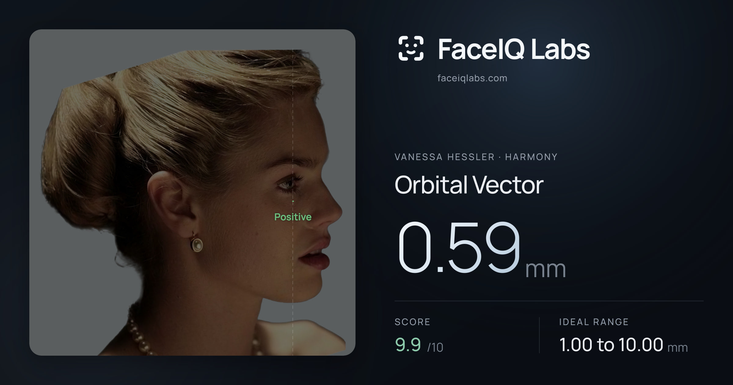Vanessa Hessler Orbital Vector: 0.59mm, drawn on the photo