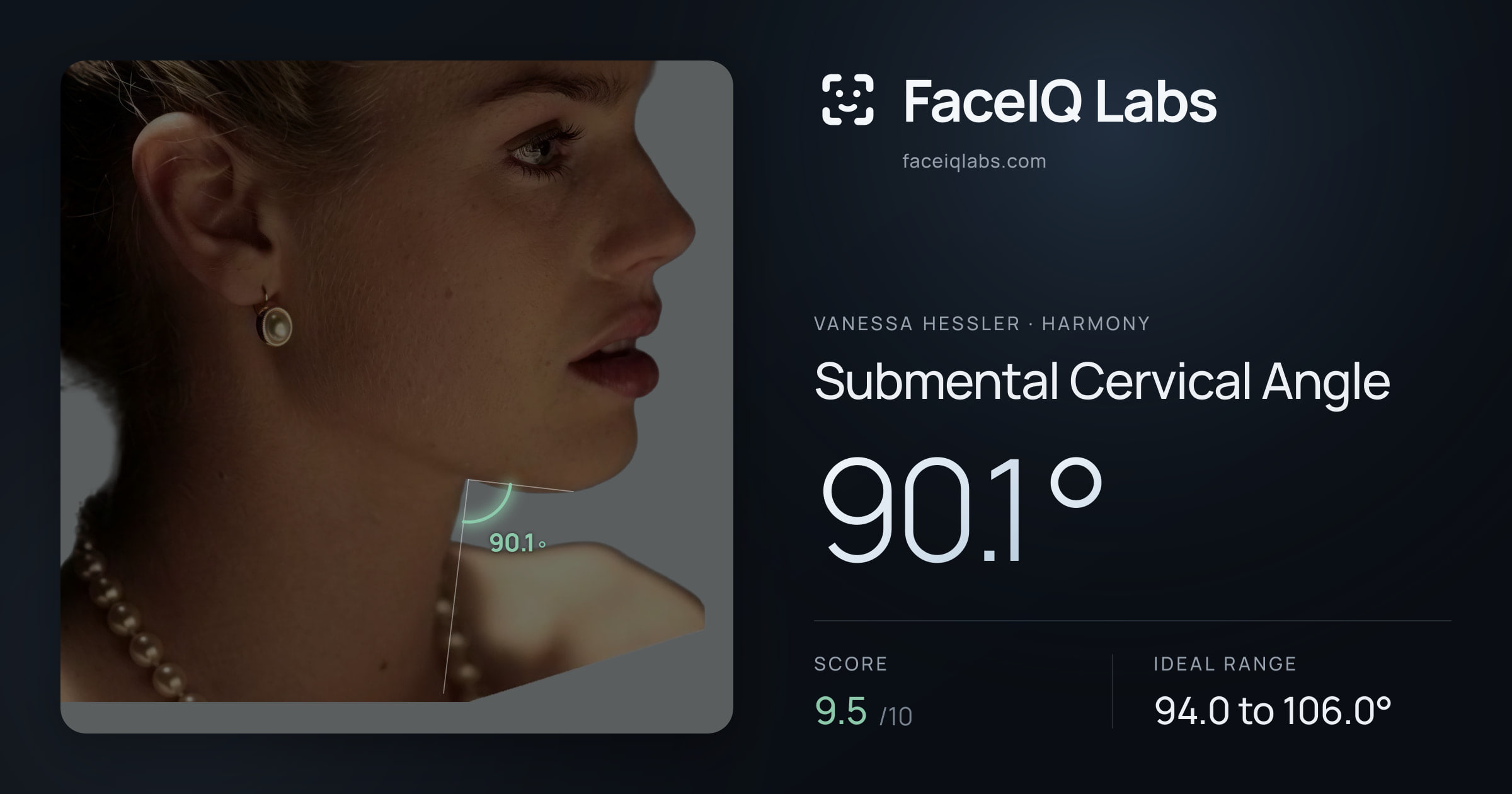 Vanessa Hessler Submental Cervical Angle: 90.1°, drawn on the photo