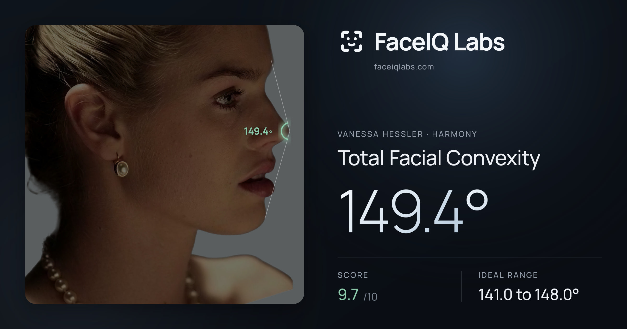 Vanessa Hessler Total Facial Convexity: 149.4°, drawn on the photo