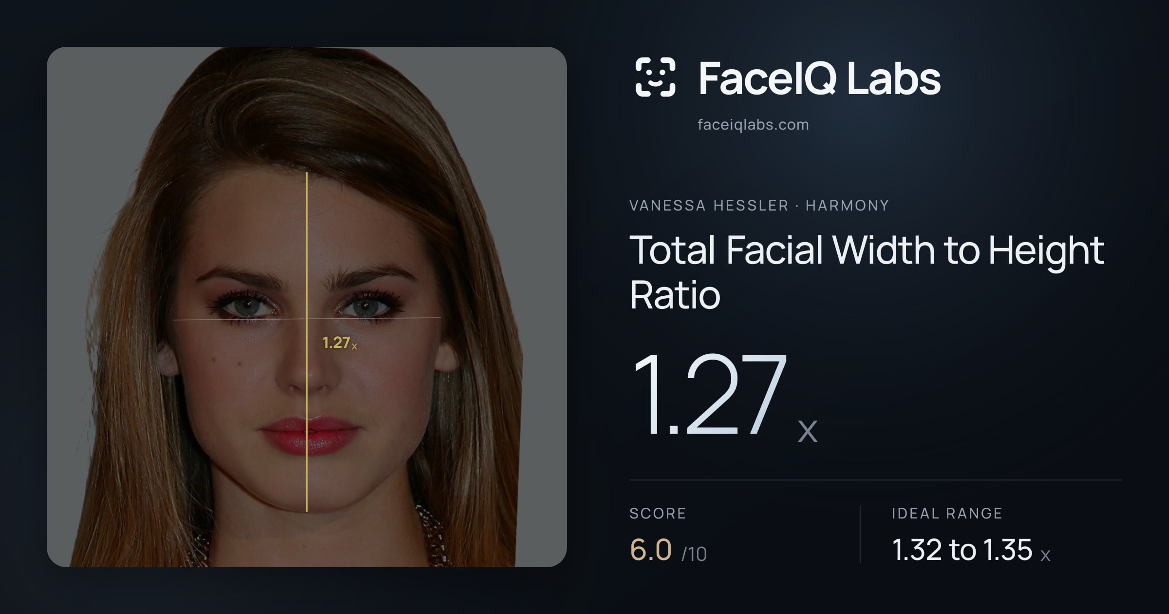 Vanessa Hessler Total Facial Width to Height Ratio: 1.27x, drawn on the photo
