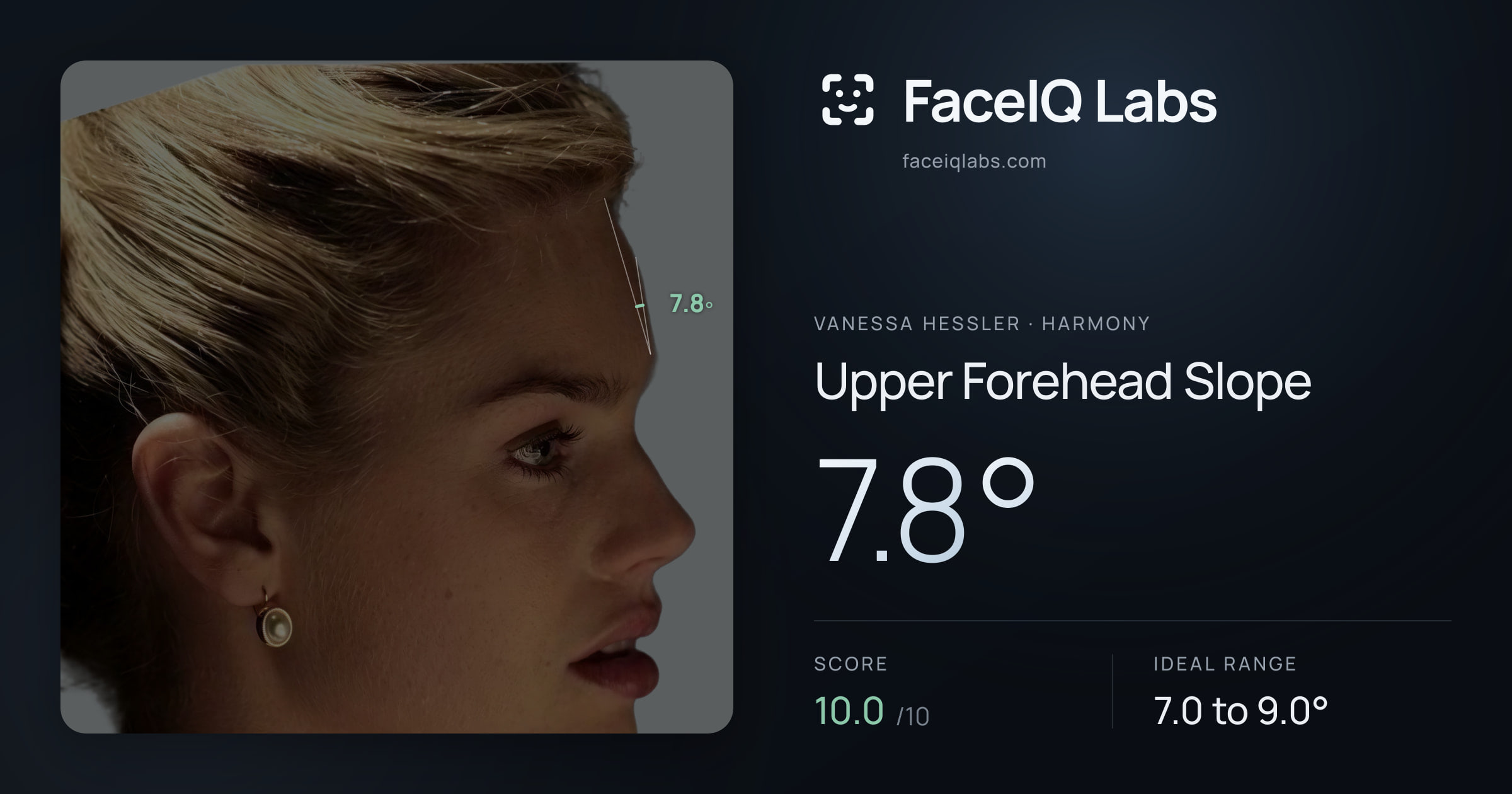 Vanessa Hessler Upper Forehead Slope: 7.8°, drawn on the photo