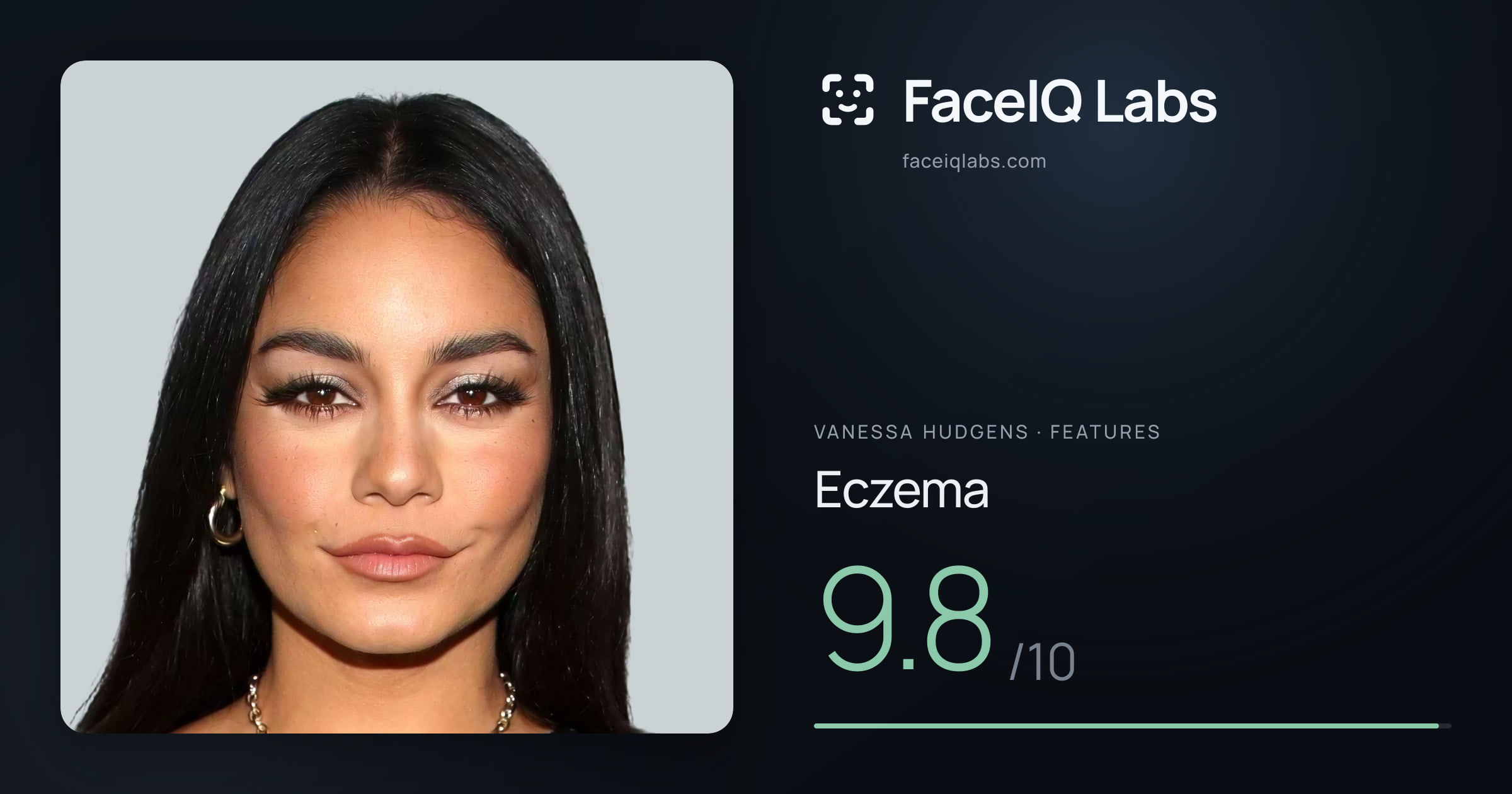 Vanessa Hudgens Eczema: 9.8/10, drawn on the photo