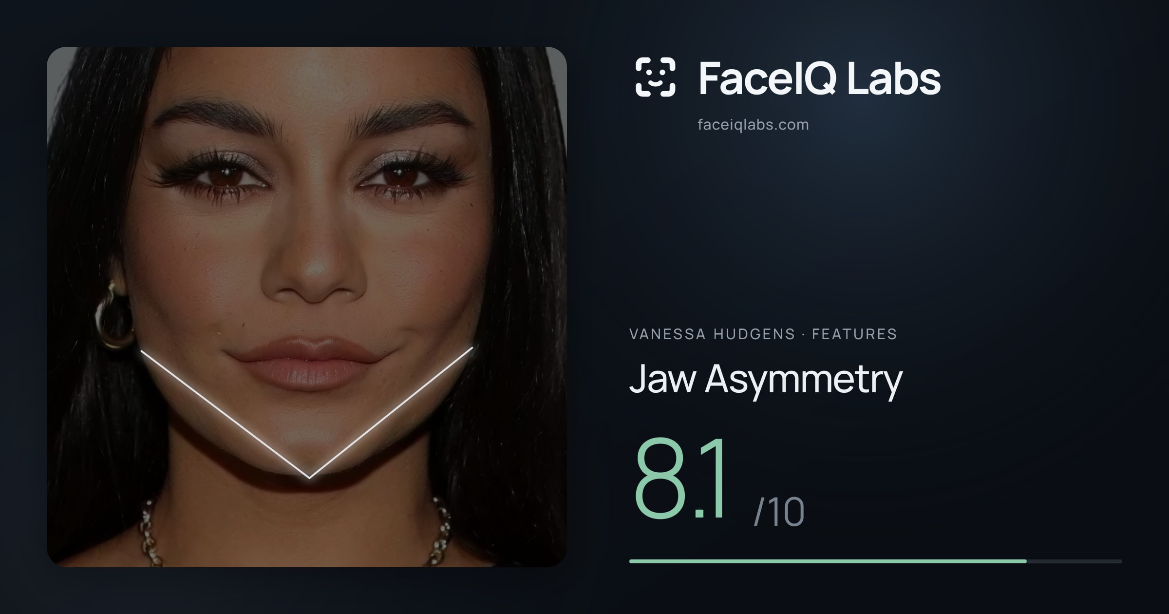 Vanessa Hudgens Jaw Asymmetry: 8.1/10, drawn on the photo