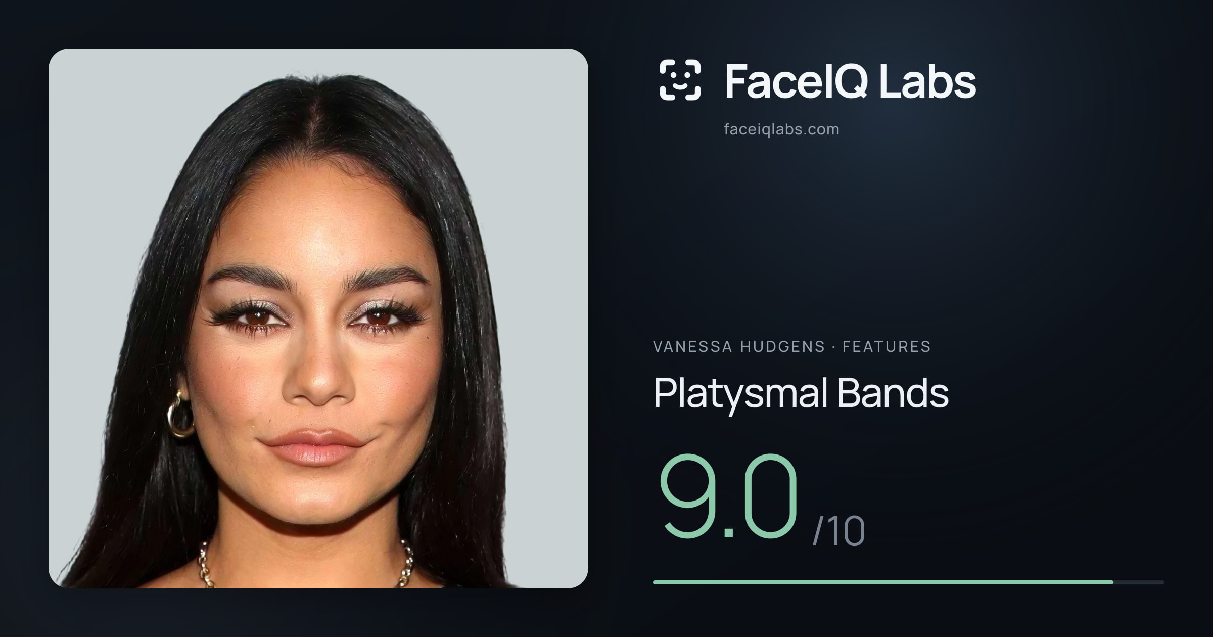 Vanessa Hudgens Platysmal Bands: 9.0/10, drawn on the photo