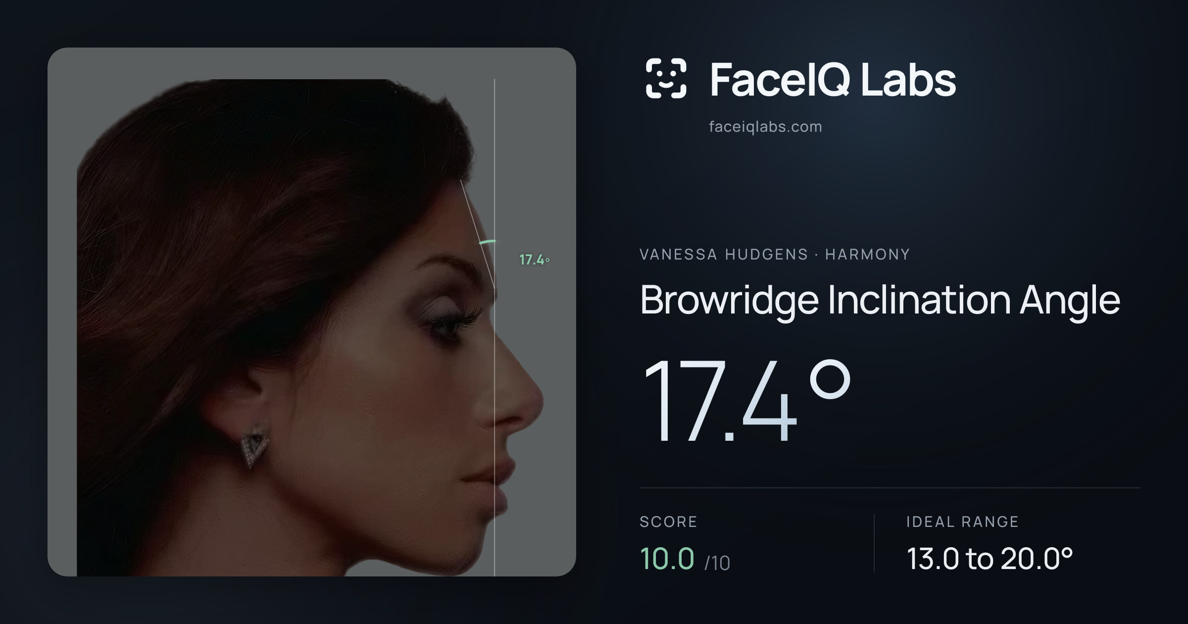 Vanessa Hudgens Browridge Inclination Angle: 17.4°, drawn on the photo