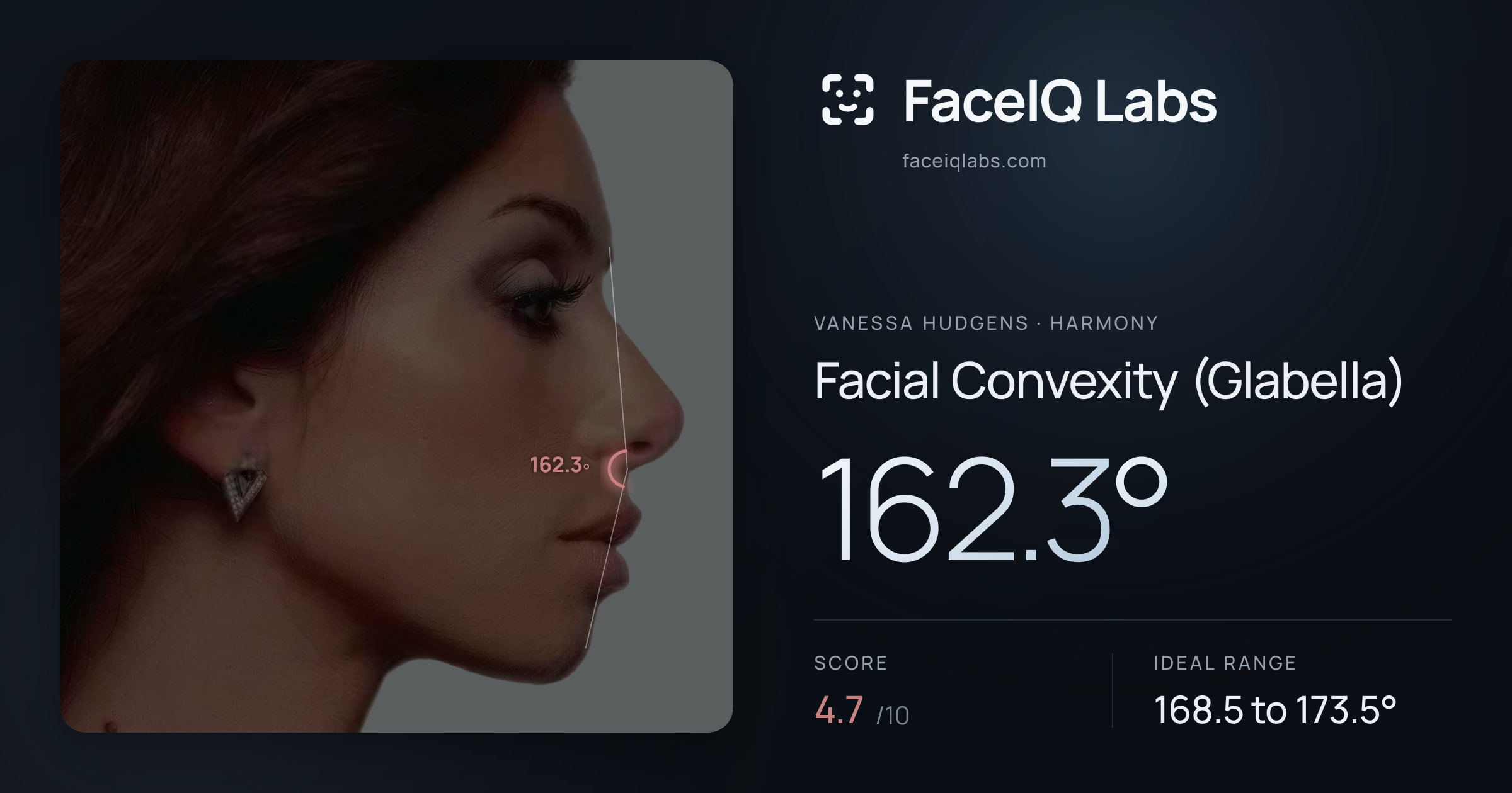 Vanessa Hudgens Facial Convexity (Glabella): 162.3°, drawn on the photo