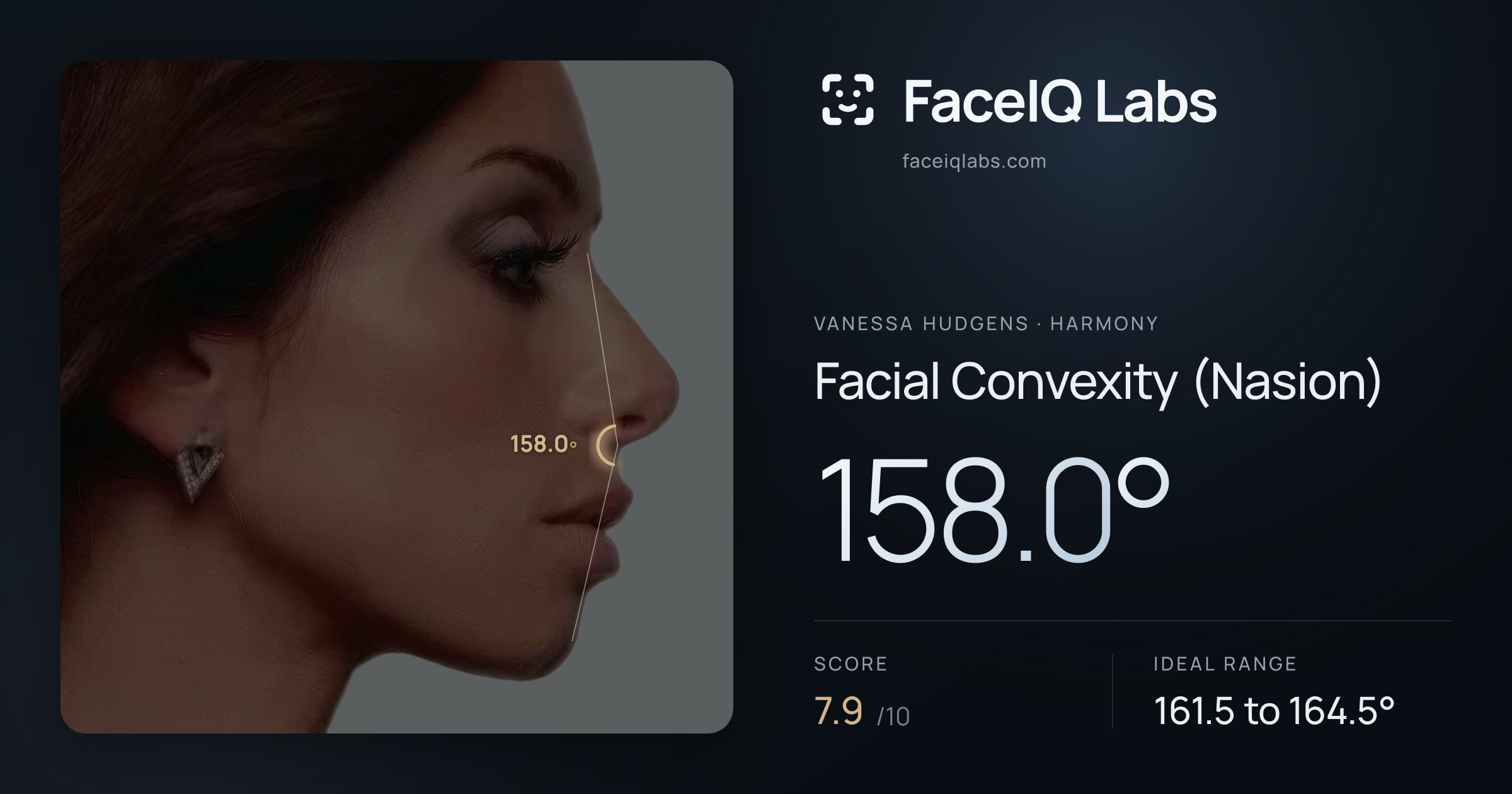 Vanessa Hudgens Facial Convexity (Nasion): 158.0°, drawn on the photo