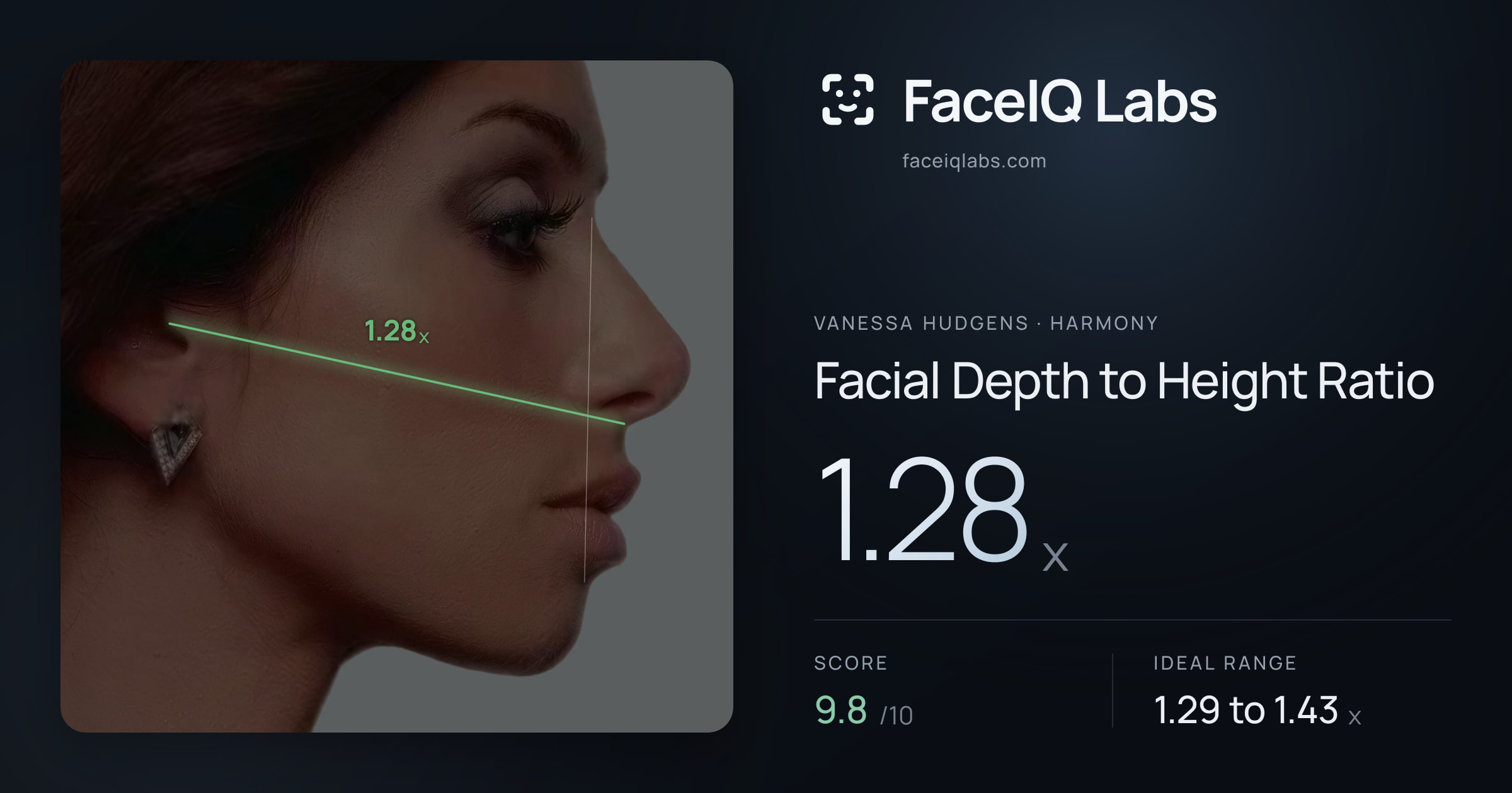 Vanessa Hudgens Facial Depth to Height Ratio: 1.28x, drawn on the photo