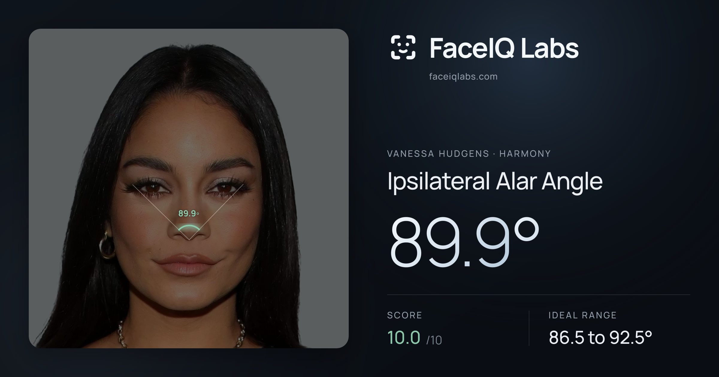 Vanessa Hudgens Ipsilateral Alar Angle: 89.9°, drawn on the photo