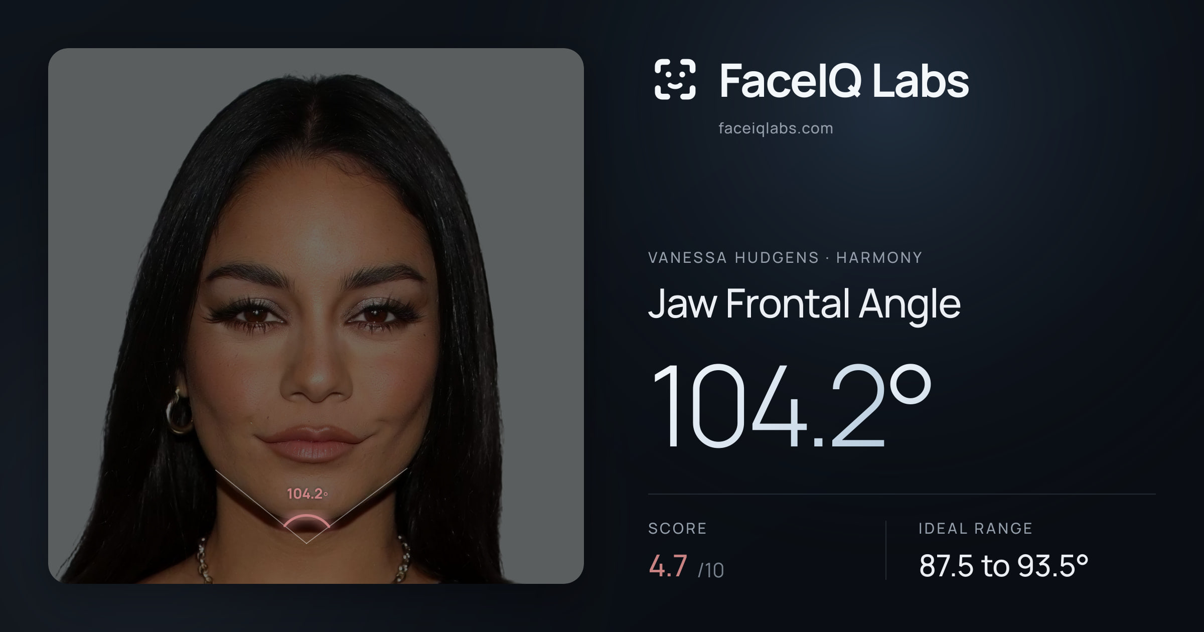 Vanessa Hudgens Jaw Frontal Angle: 104.2°, drawn on the photo