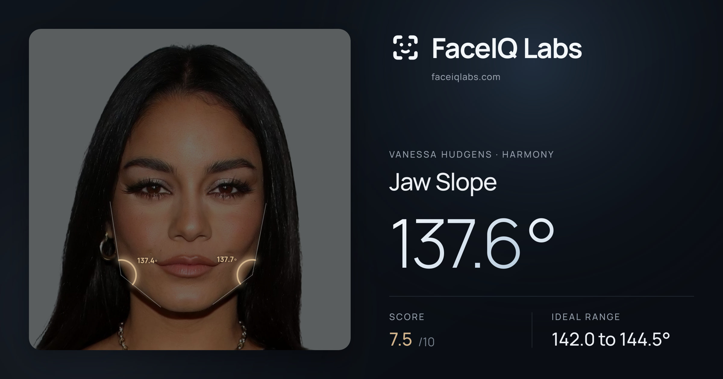Vanessa Hudgens Jaw Slope: 137.6°, drawn on the photo