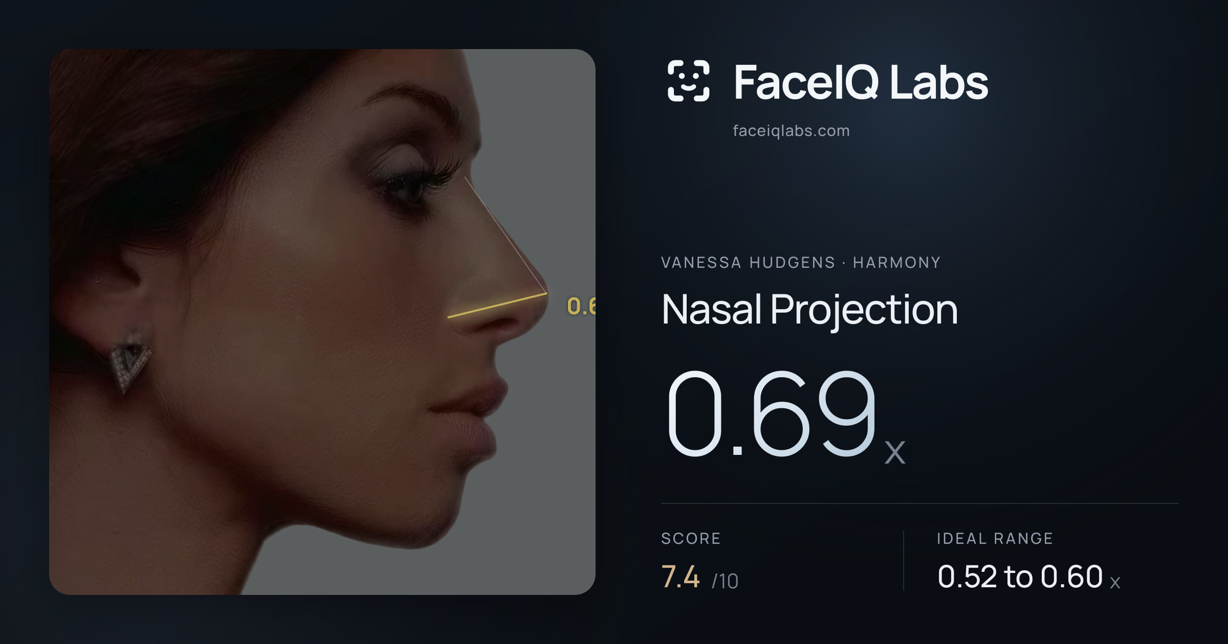 Vanessa Hudgens Nasal Projection: 0.69x, drawn on the photo
