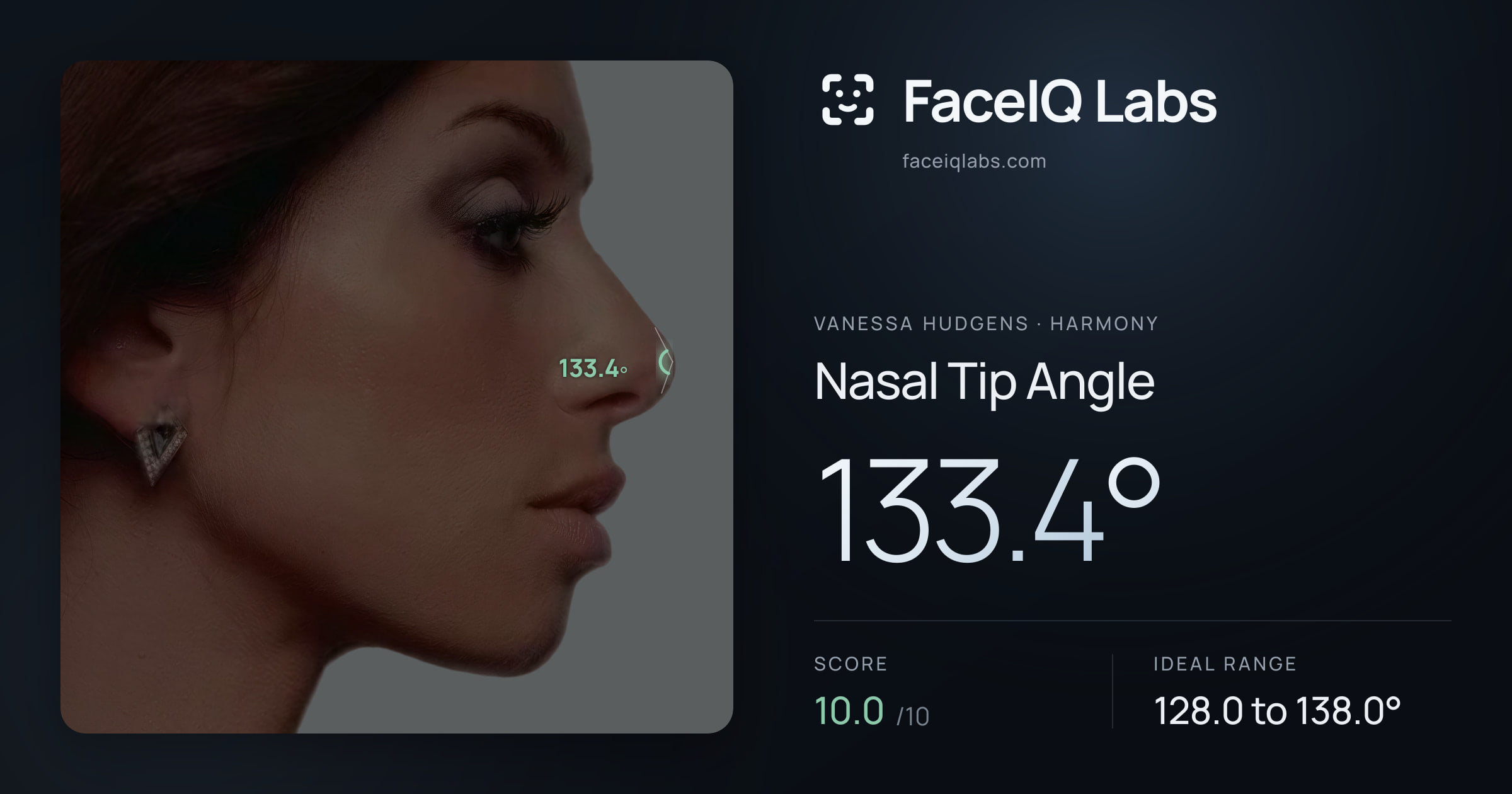 Vanessa Hudgens Nasal Tip Angle: 133.4°, drawn on the photo