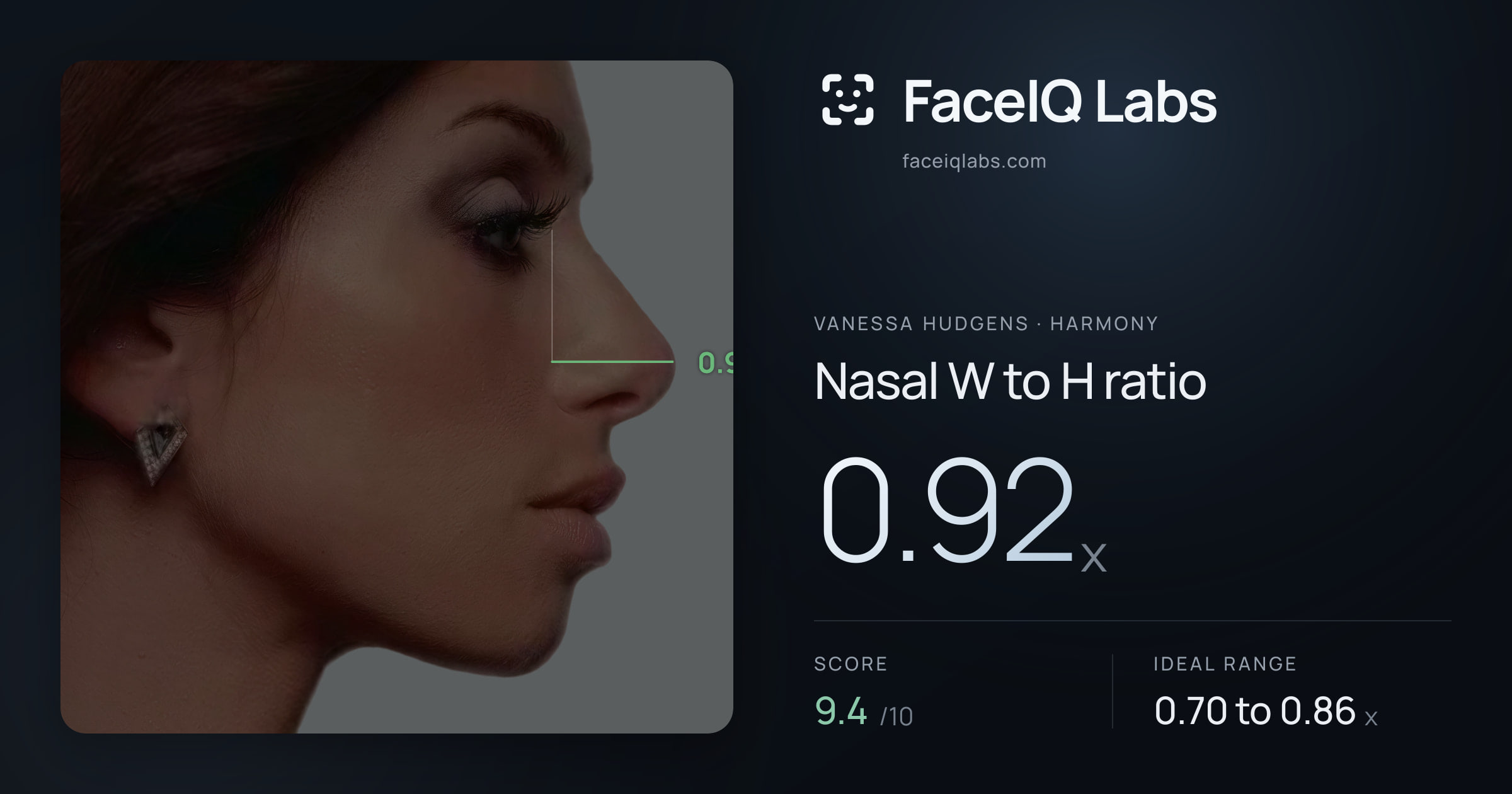 Vanessa Hudgens Nasal W to H ratio: 0.92x, drawn on the photo