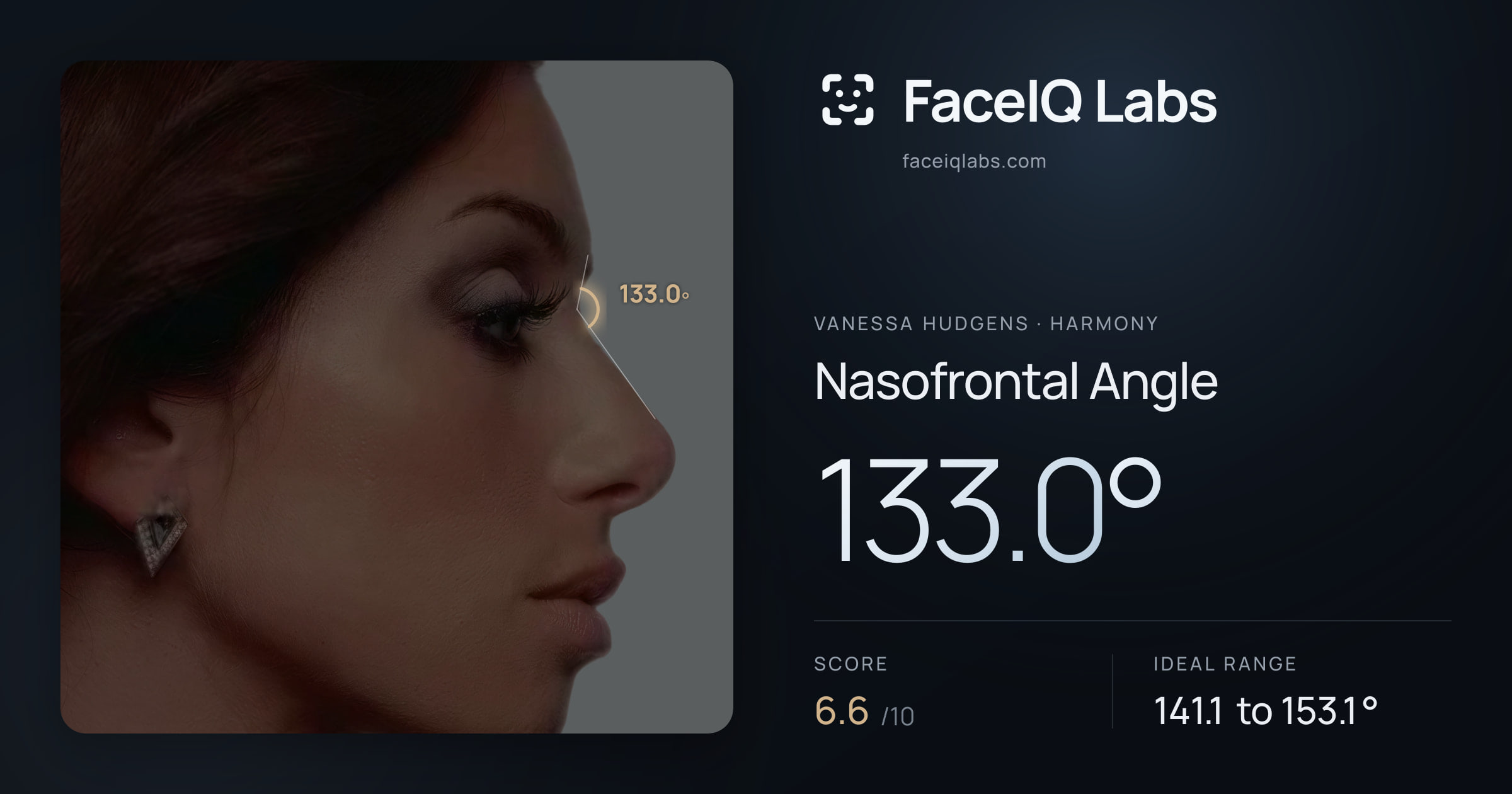 Vanessa Hudgens Nasofrontal Angle: 133.0°, drawn on the photo