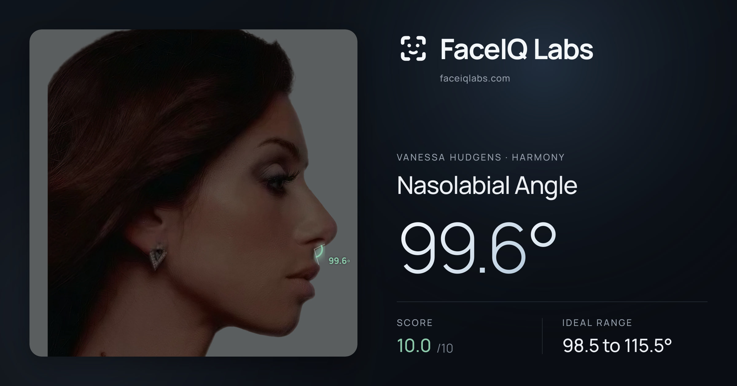 Vanessa Hudgens Nasolabial Angle: 99.6°, drawn on the photo