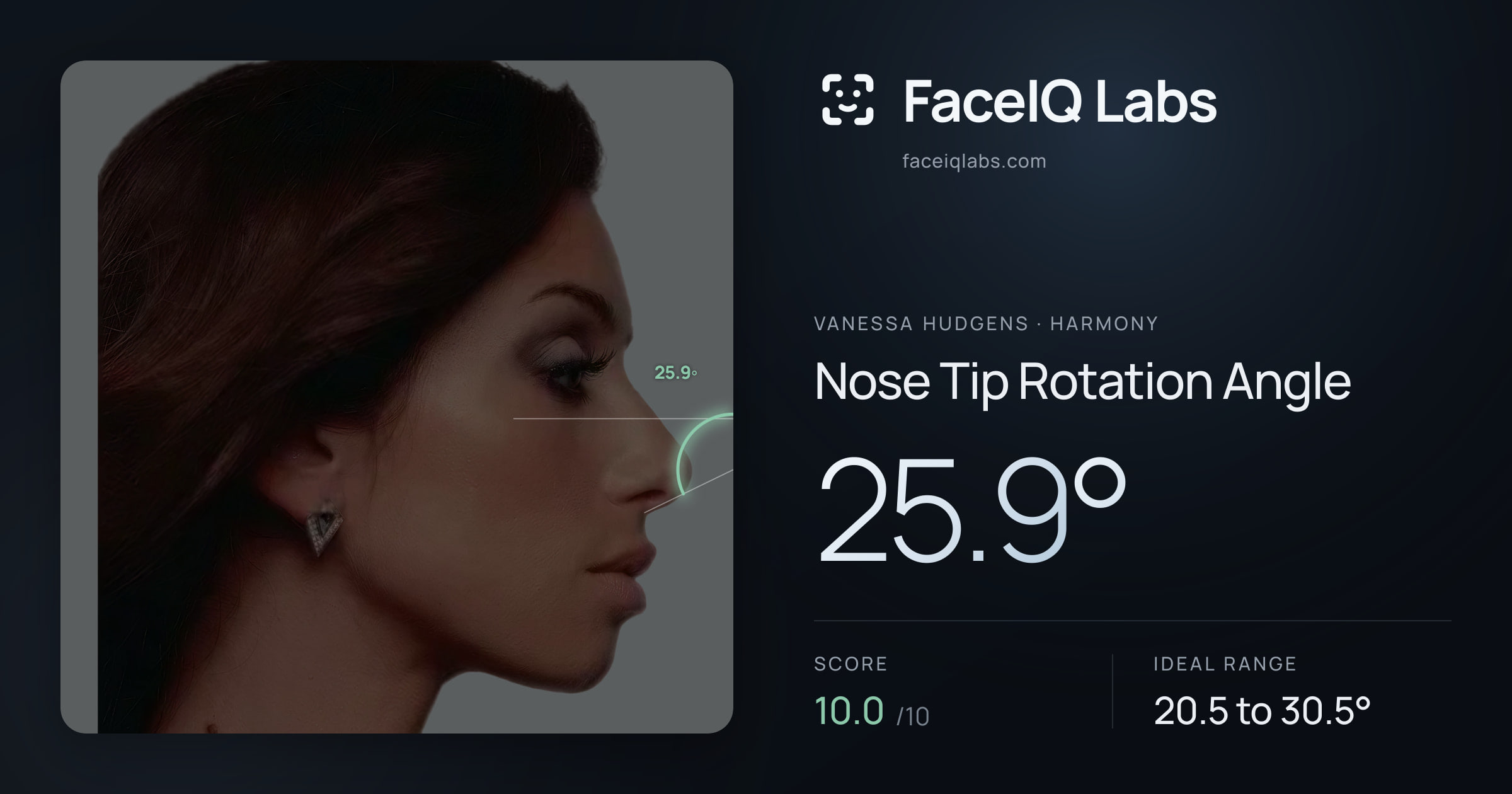 Vanessa Hudgens Nose Tip Rotation Angle: 25.9°, drawn on the photo