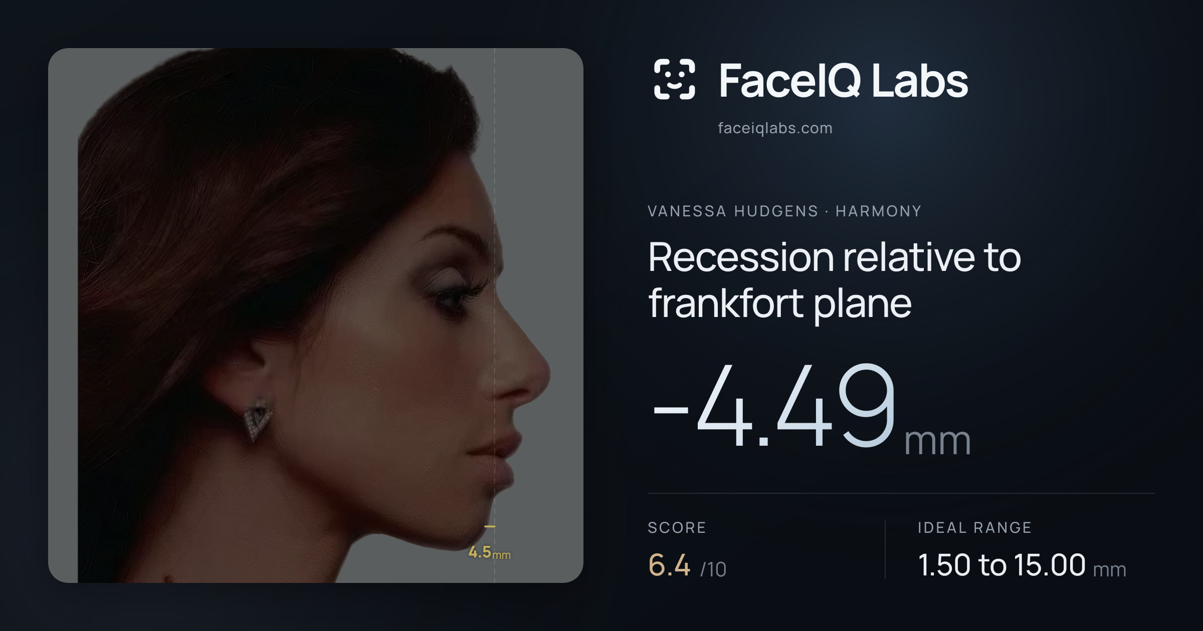 Vanessa Hudgens Recession relative to frankfort plane: -4.49mm, drawn on the photo