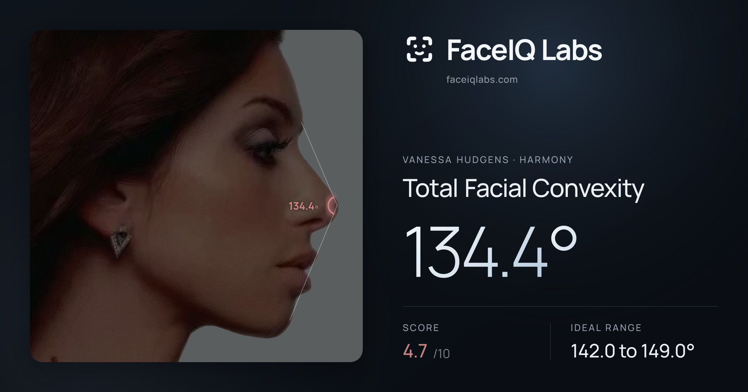 Vanessa Hudgens Total Facial Convexity: 134.4°, drawn on the photo