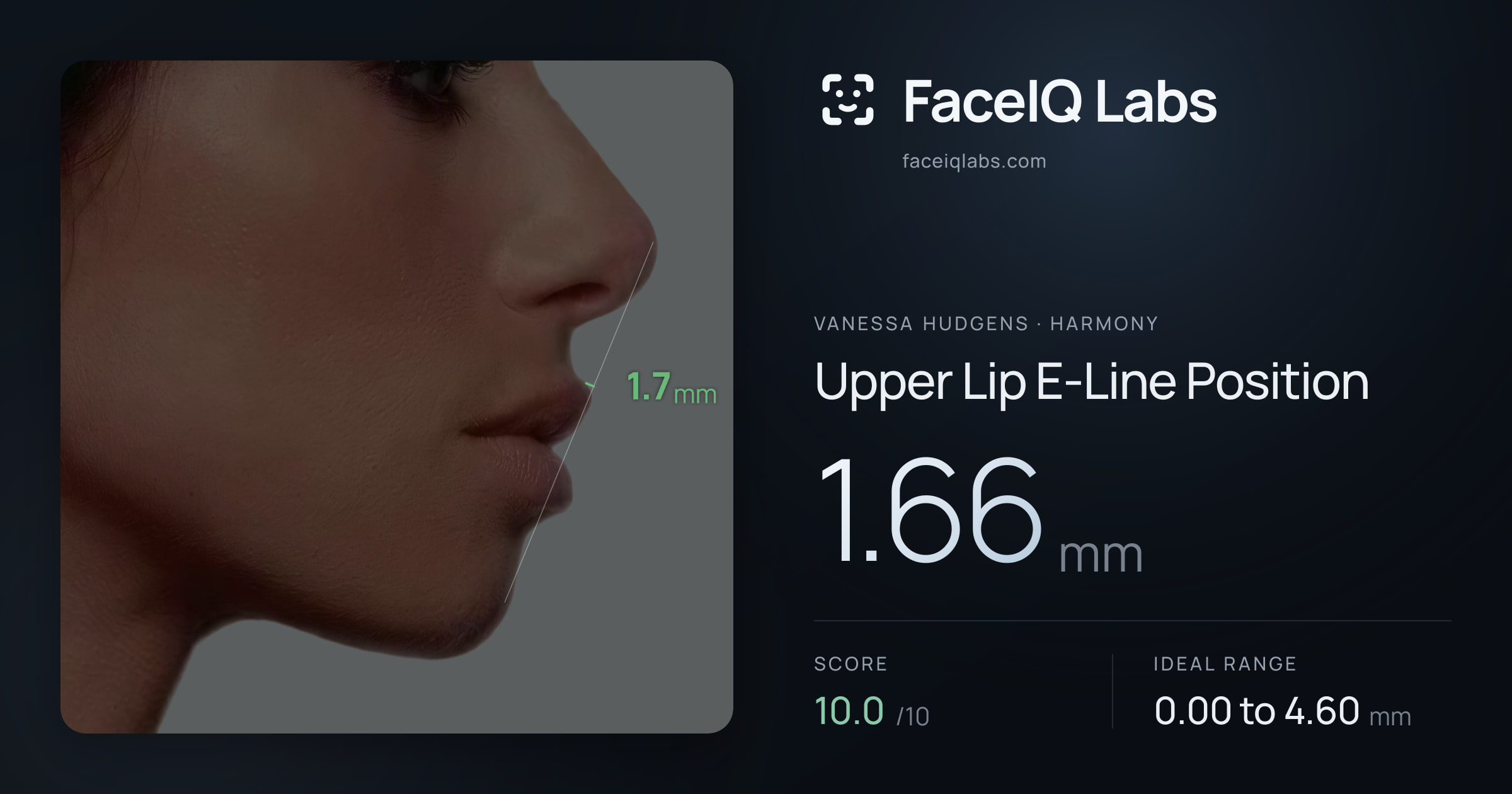 Vanessa Hudgens Upper Lip E-Line Position: 1.66mm, drawn on the photo