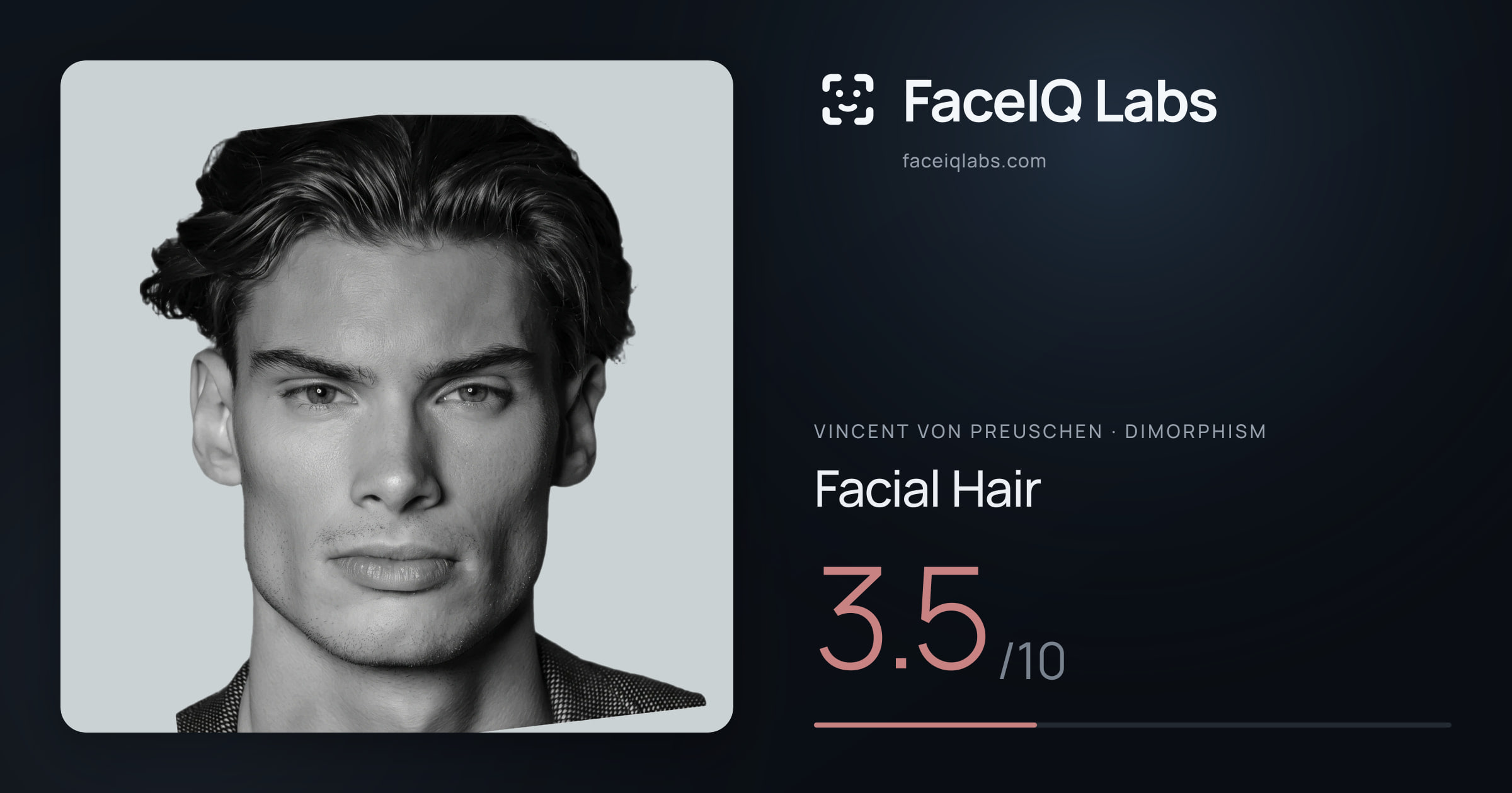 Vincent von Preuschen Facial Hair: 3.5/10, drawn on the photo
