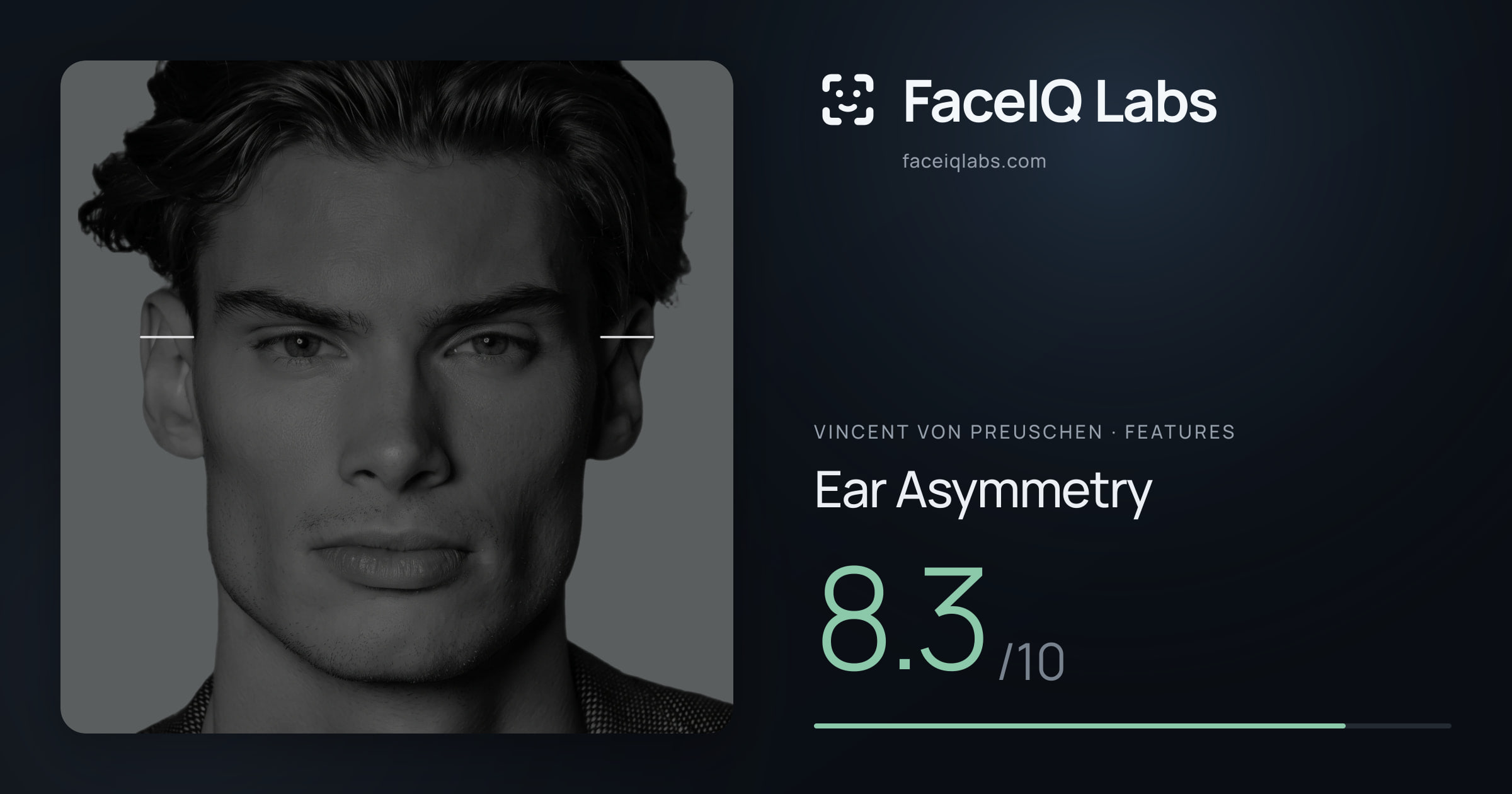 Vincent von Preuschen Ear Asymmetry: 8.3/10, drawn on the photo
