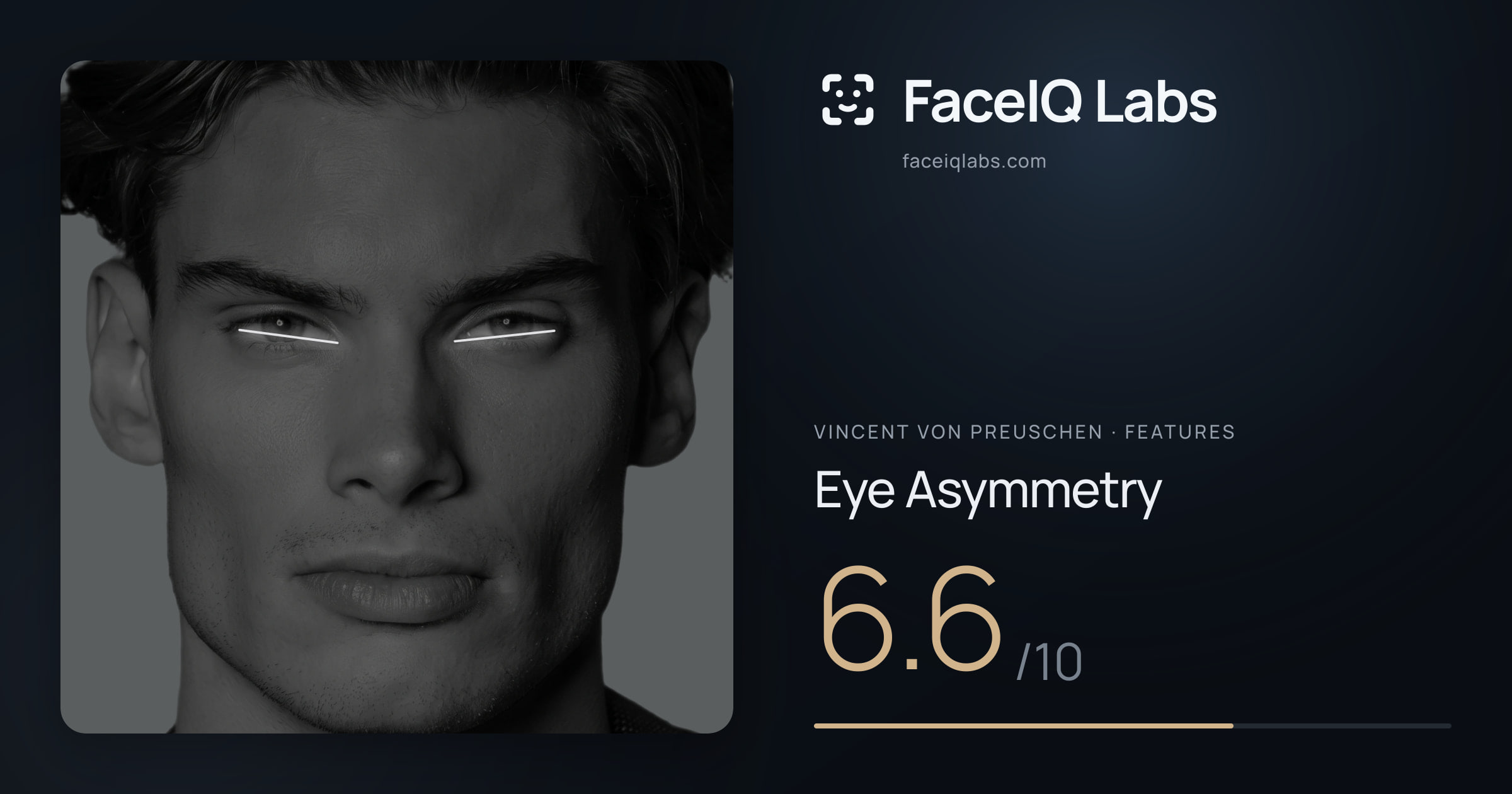 Vincent von Preuschen Eye Asymmetry: 6.6/10, drawn on the photo