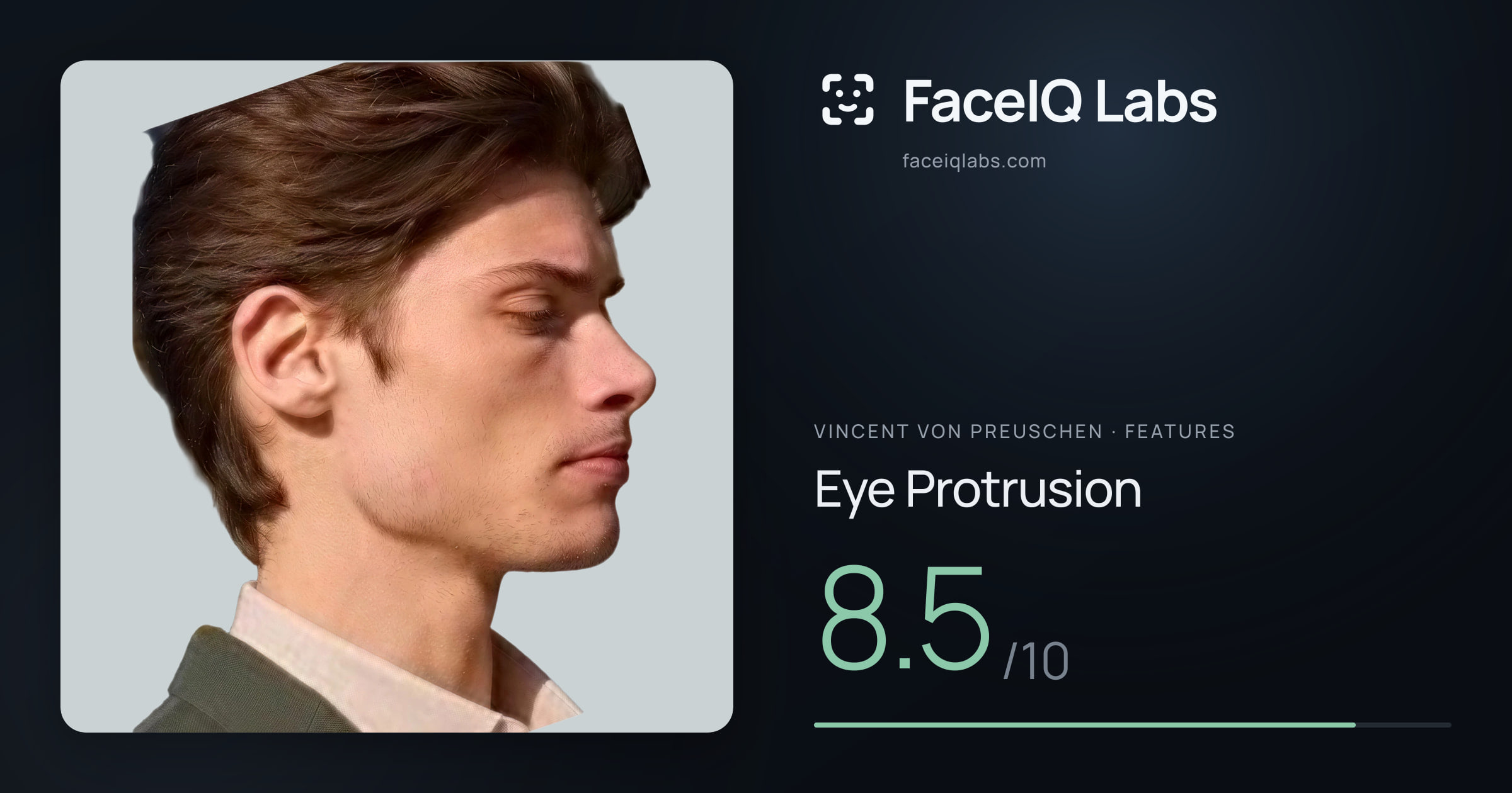 Vincent von Preuschen Eye Protrusion: 8.5/10, drawn on the photo